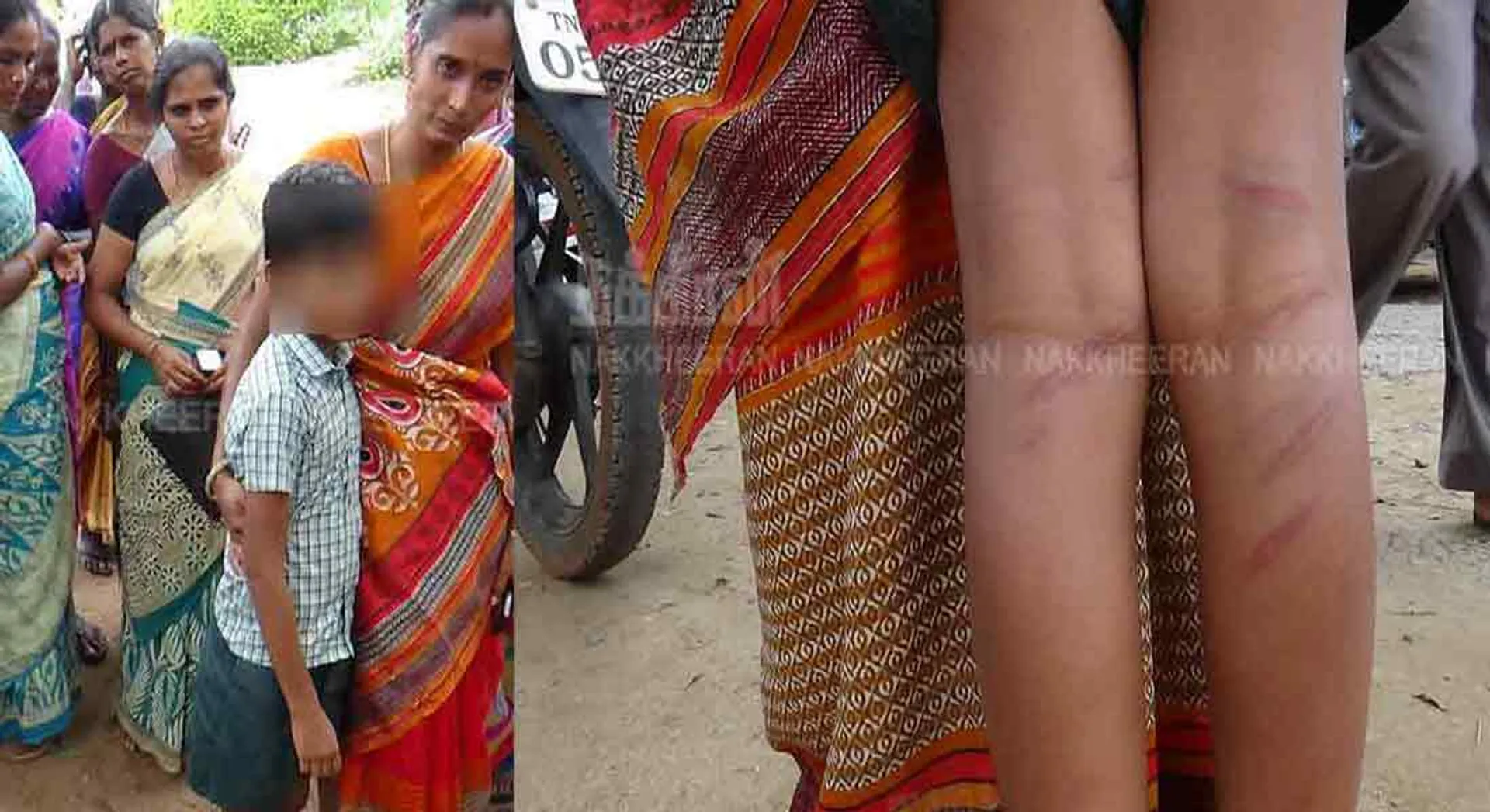  Action against teacher who hit the student