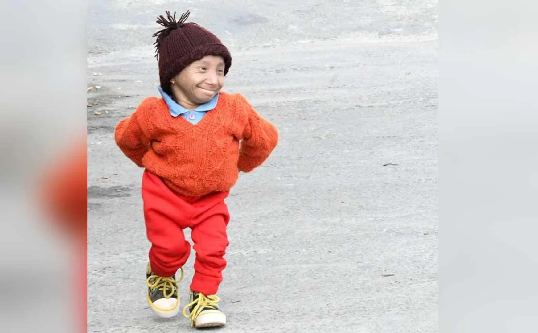worlds shortest man passed away due to pneumonia