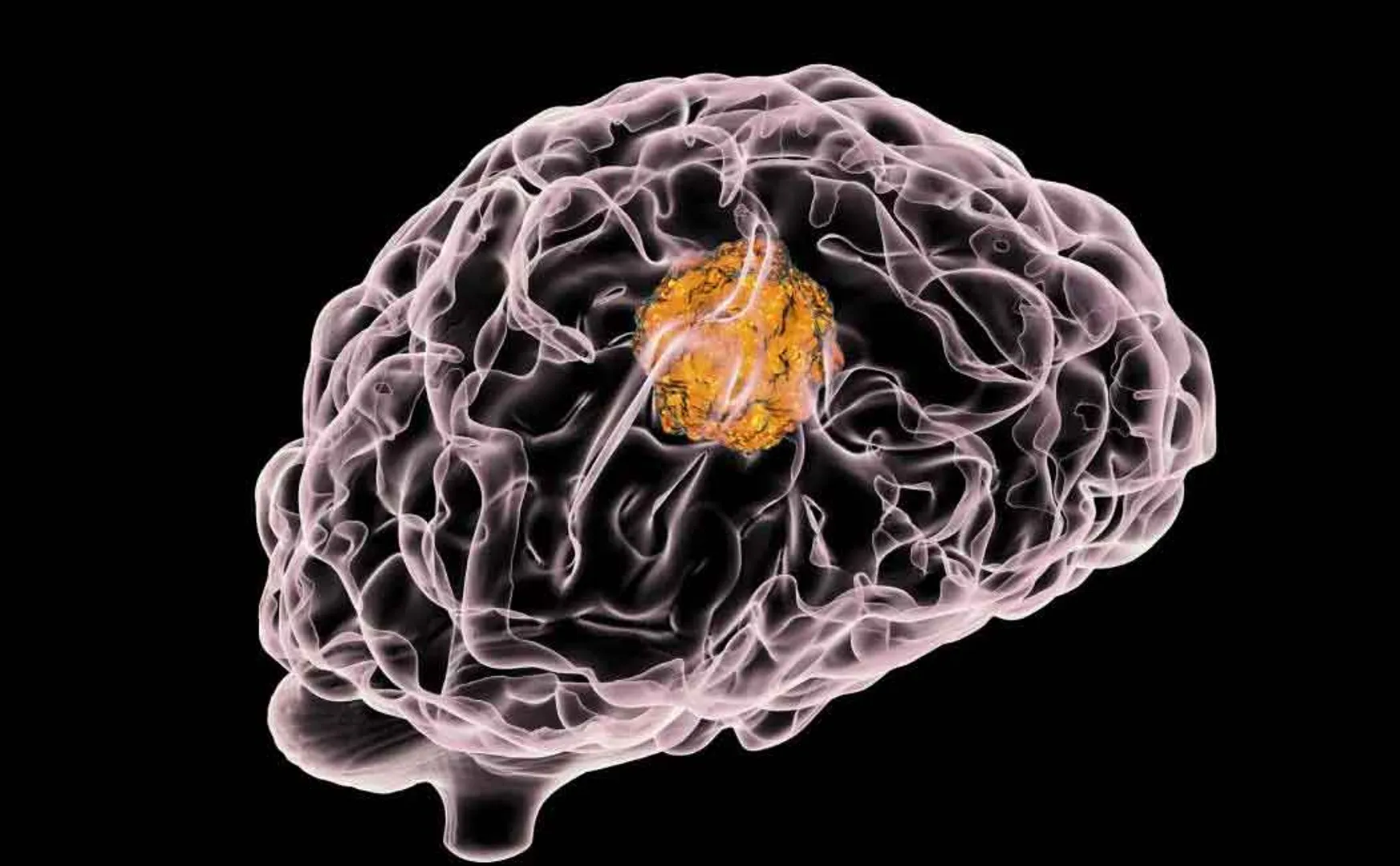brain