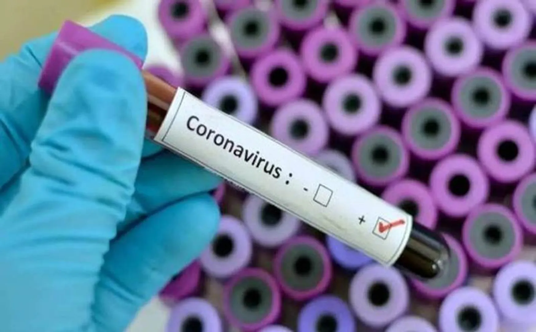 Corona Virus - Delhi AIIMS Awareness 