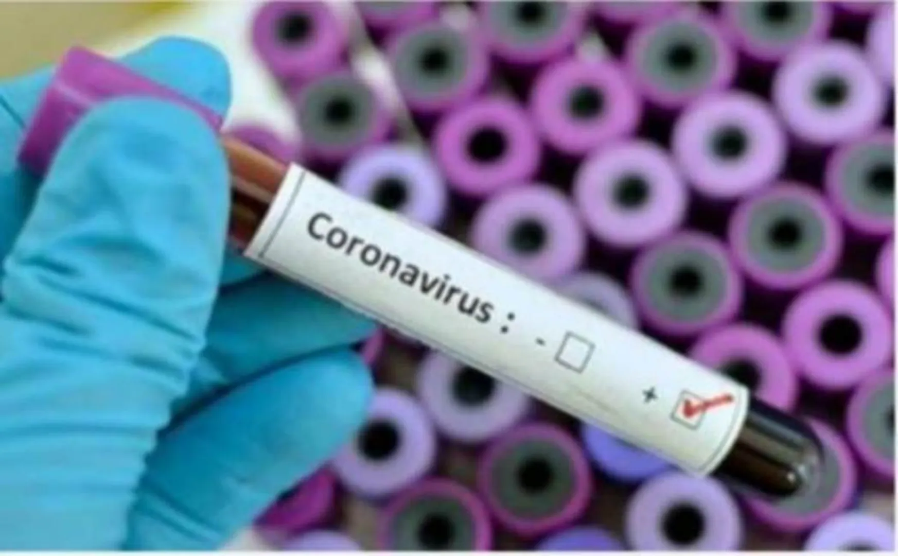 Tirunelveli has 22 new covid19 positive cases