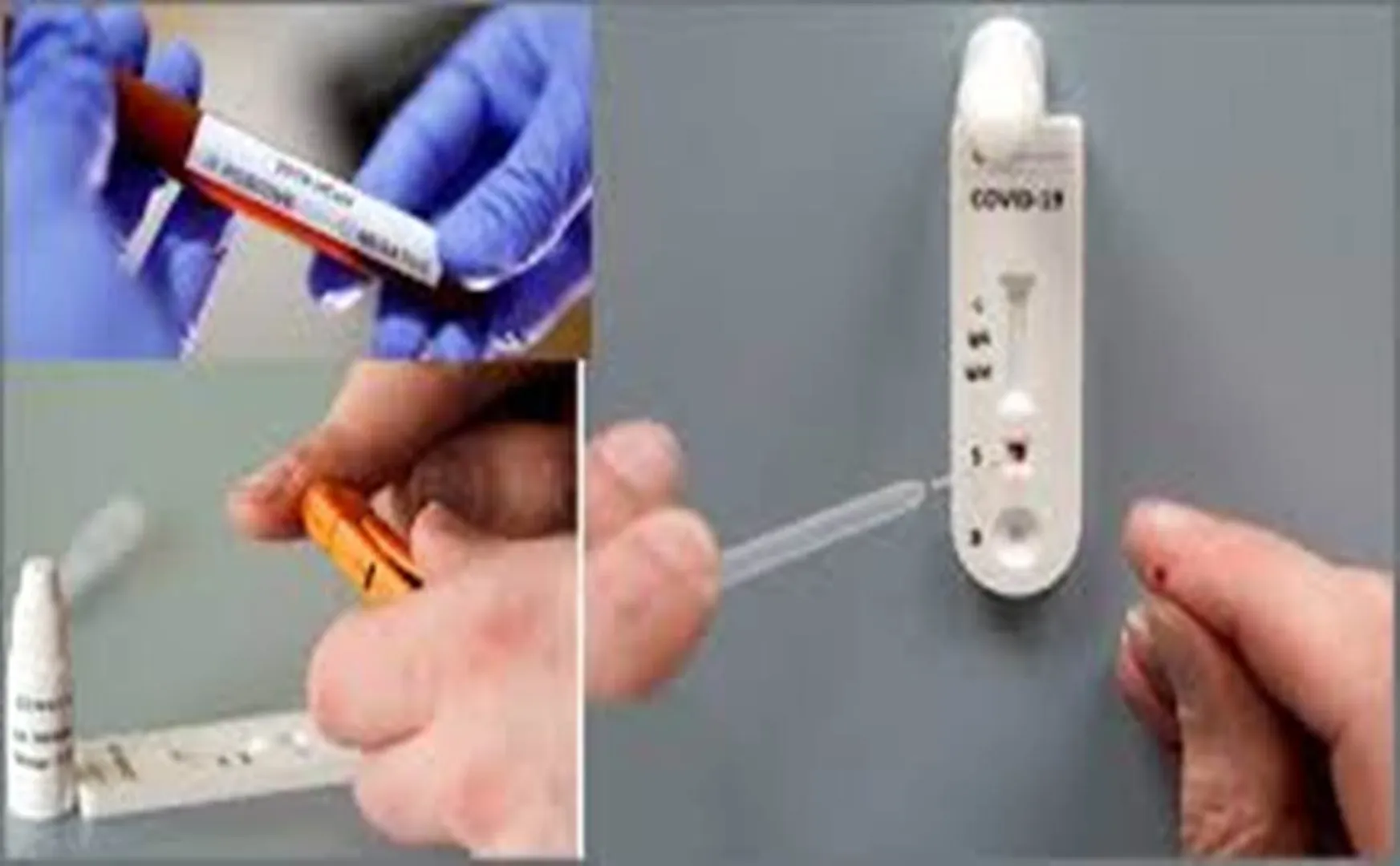 tamilnadu government Announced rapid test kit Price