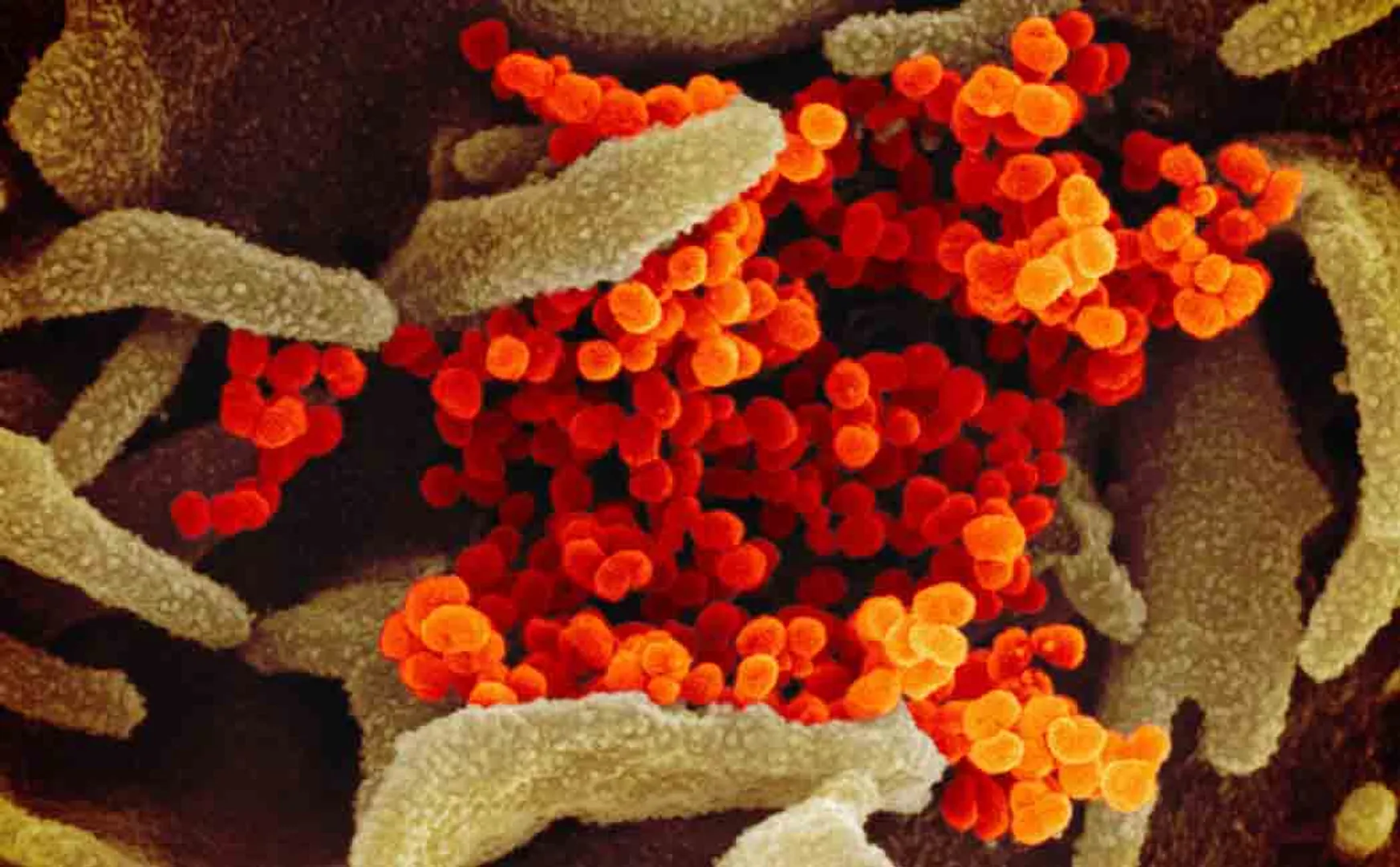 corona may stay with us like hiv