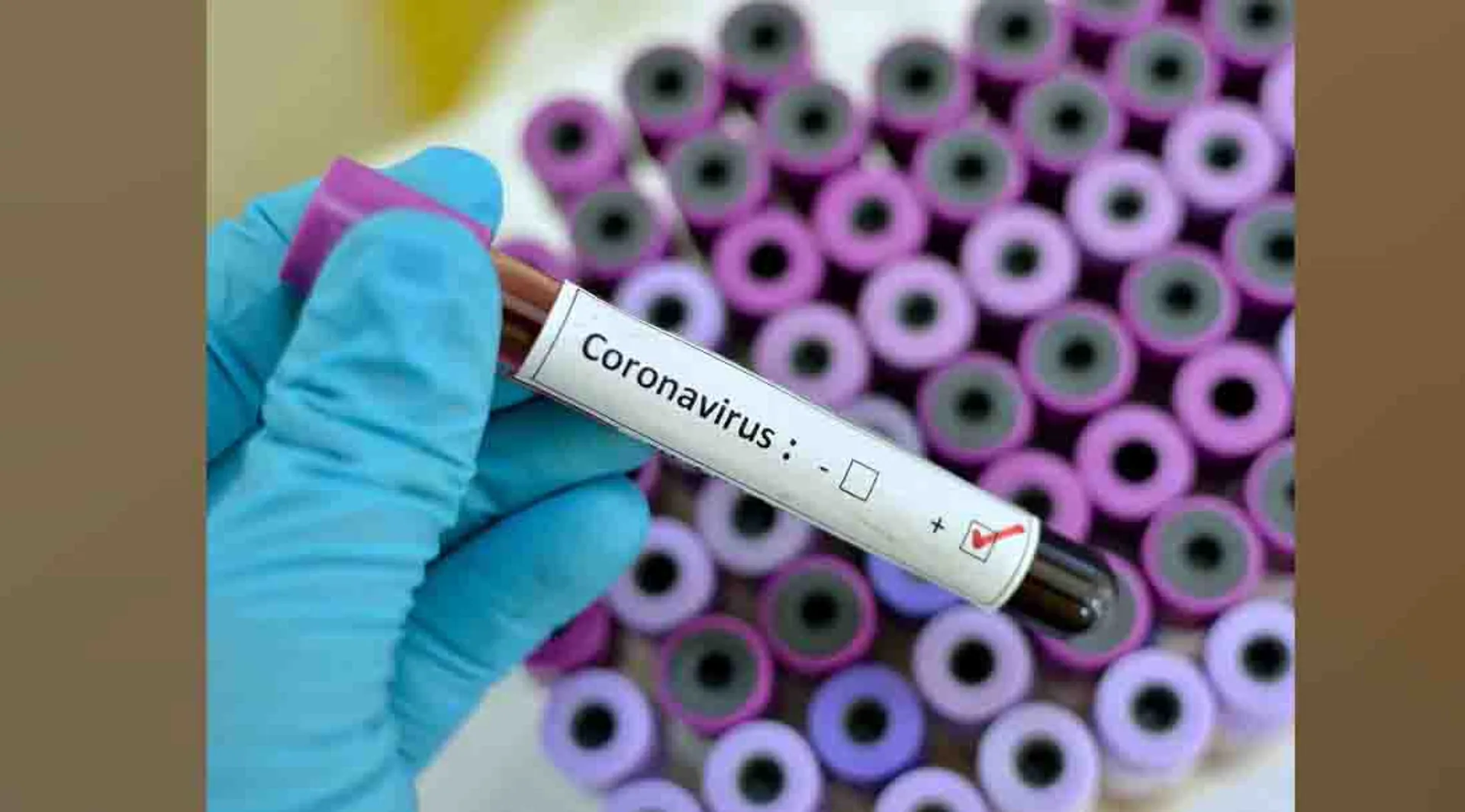 coronavirus issue