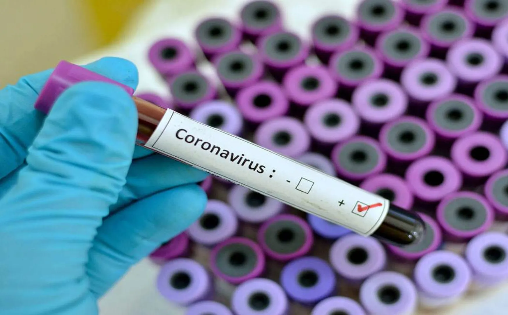 chennai corona virus updates 