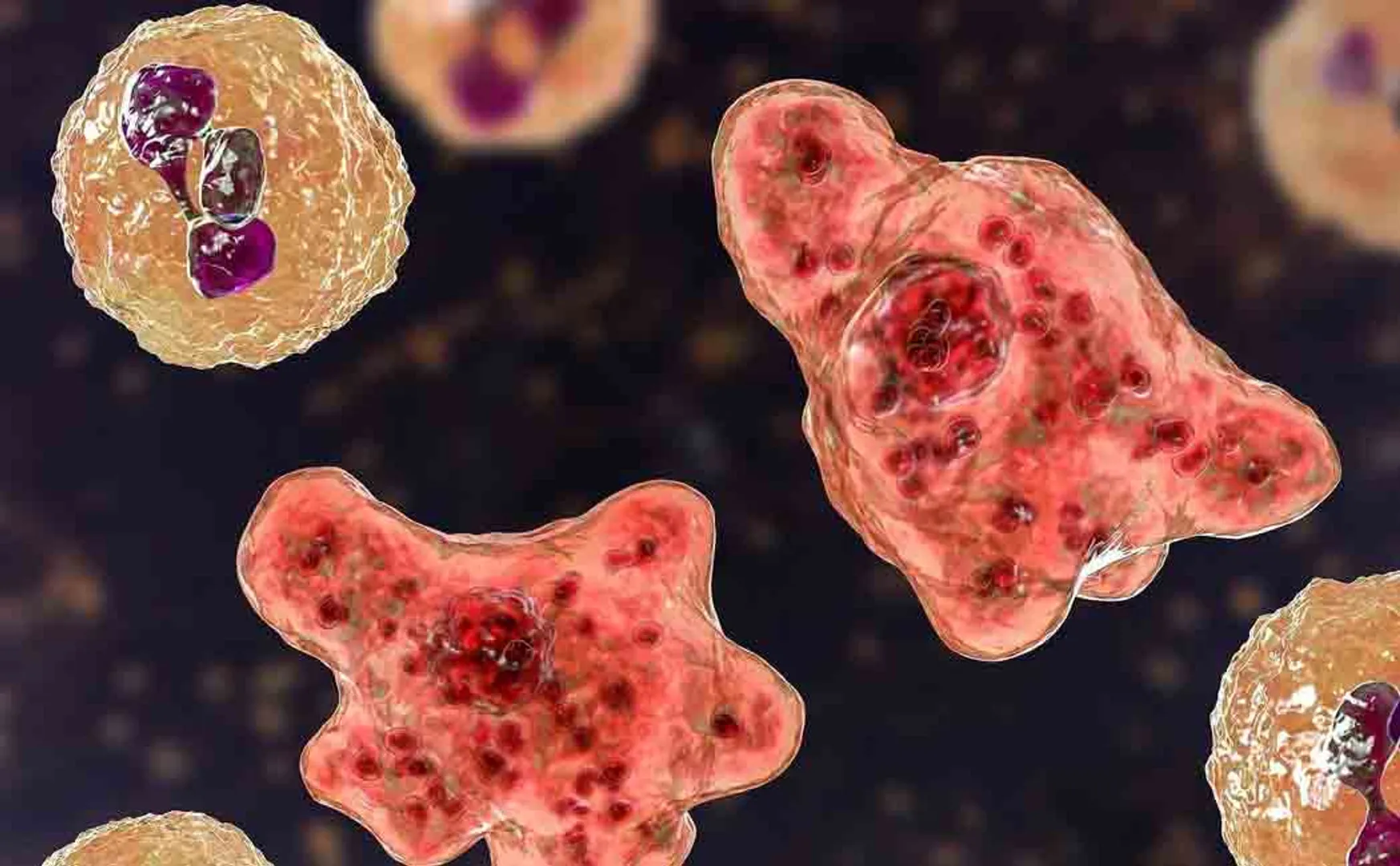 man in america affected by brain eating amoeba