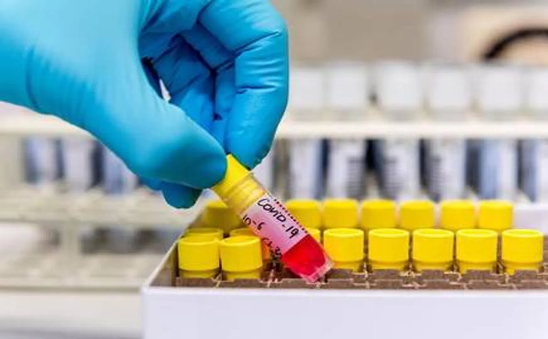 salem district mettur government hospitals coronavirus samples testing lab