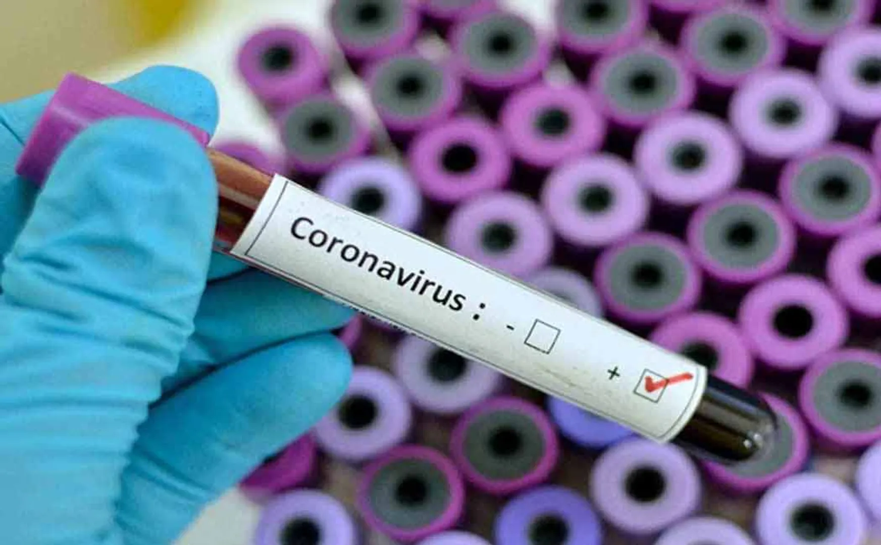 Teni district gonna reach 13,000 corona cases 