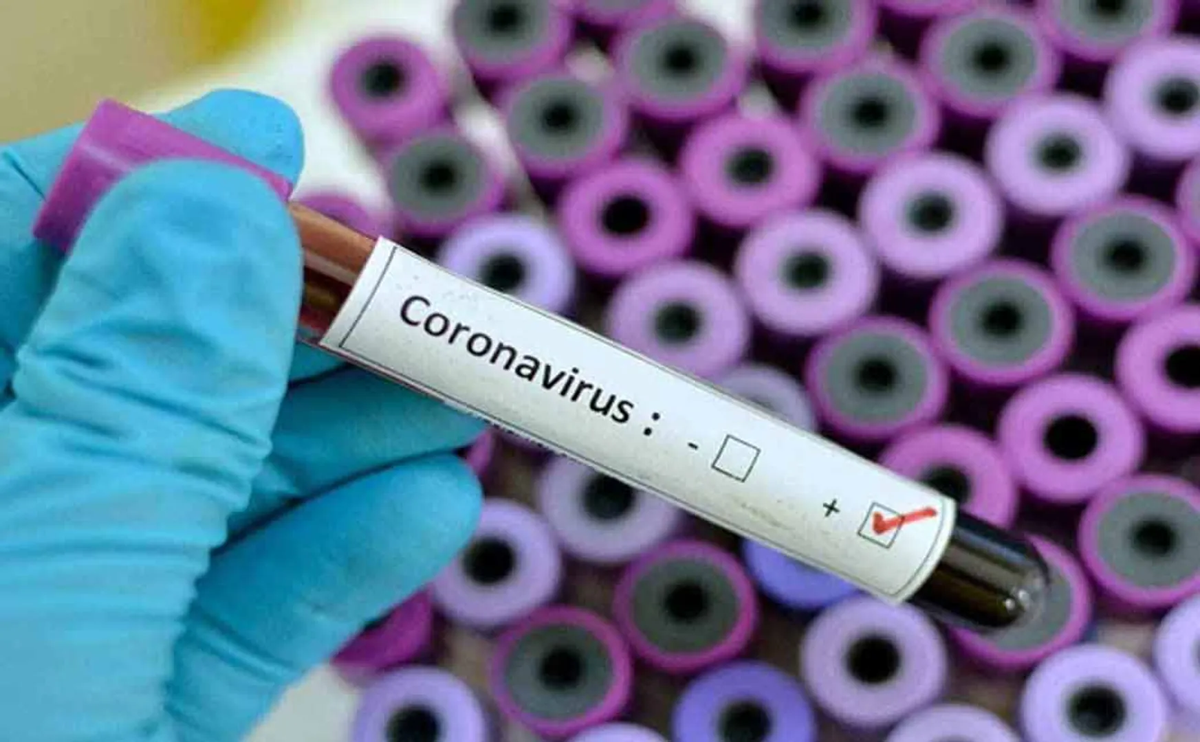 ADMK mla tested corona positive 