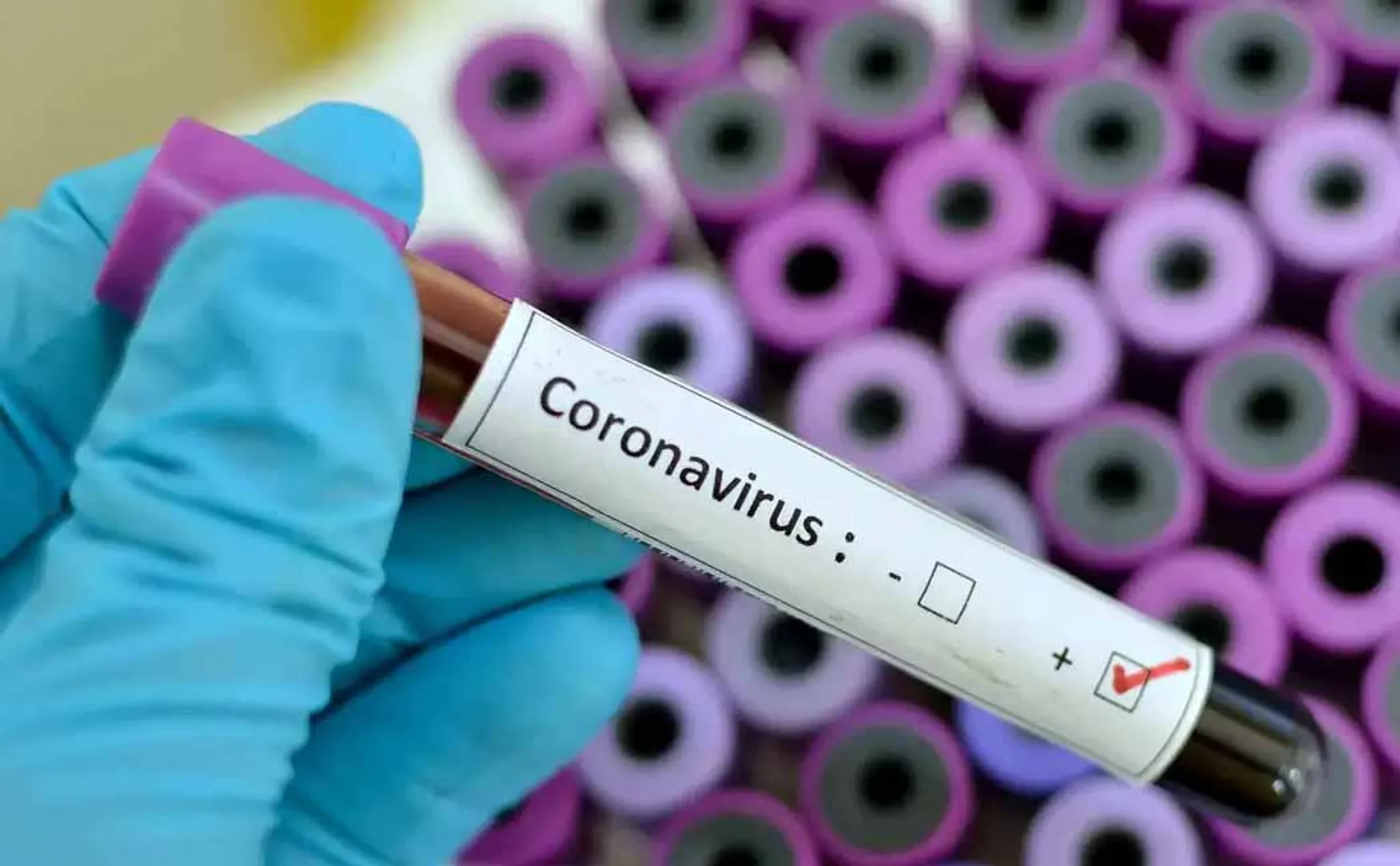 chennai colleges and hostels coronavirus positive case raise 