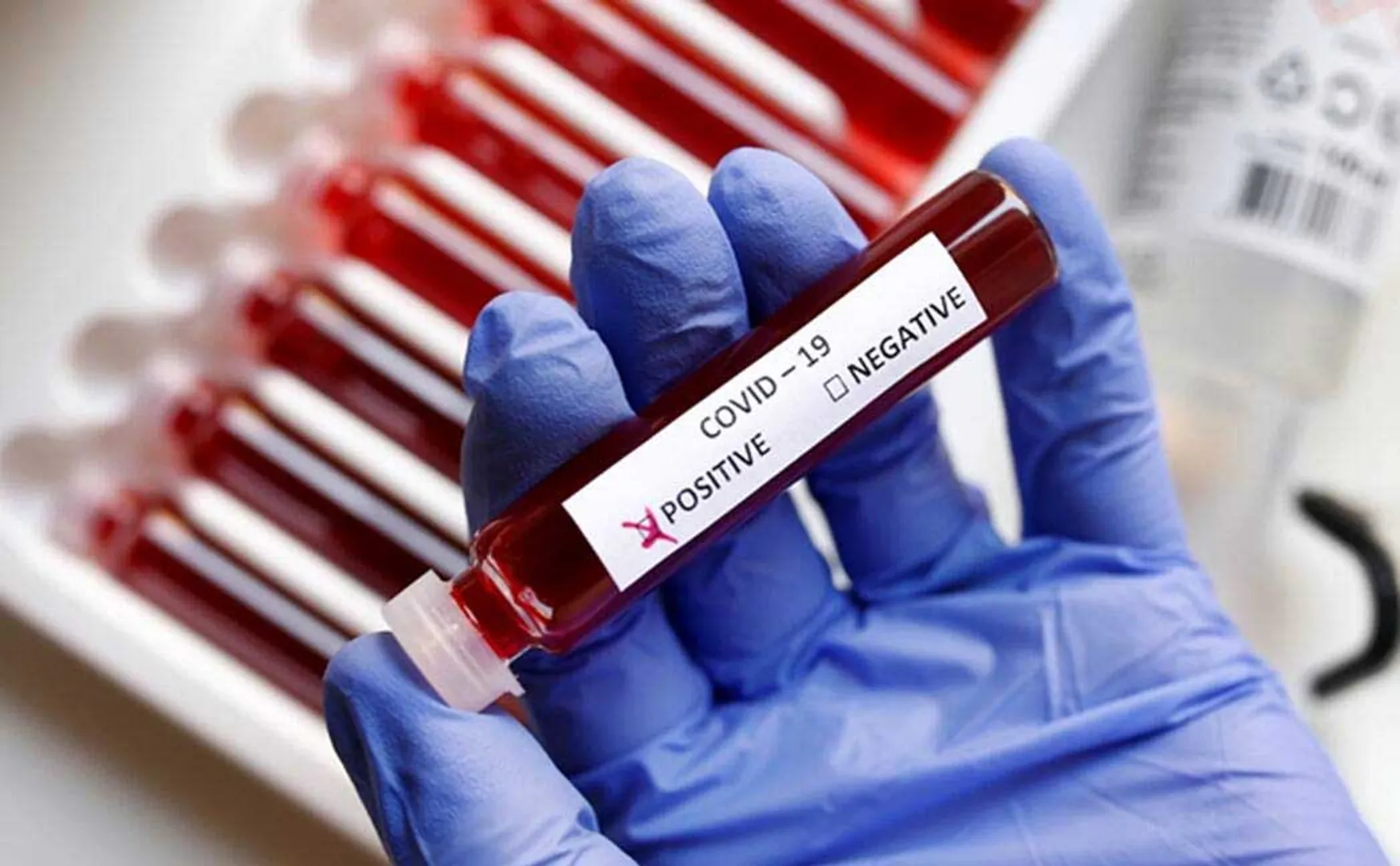 madurai govt medical college student test for covid positive 