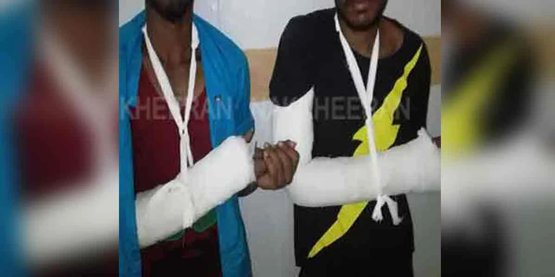 jewelery robbers who fell after a long day!