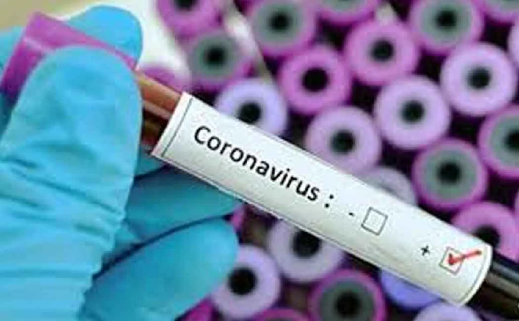 Corona to Aruppukottai election official Treatment at Madurai Private Hospital