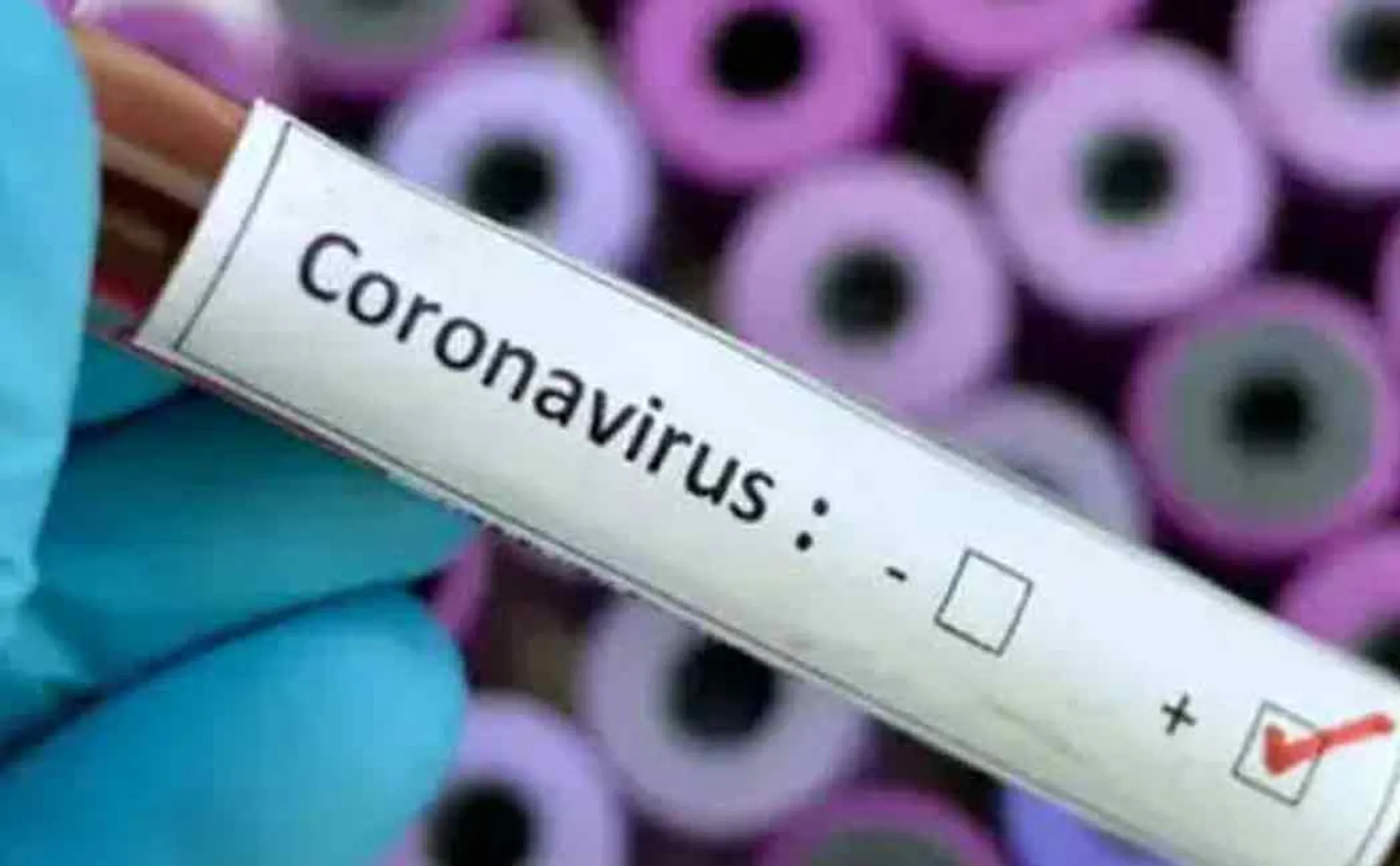 40 people tested covid positive in same company 