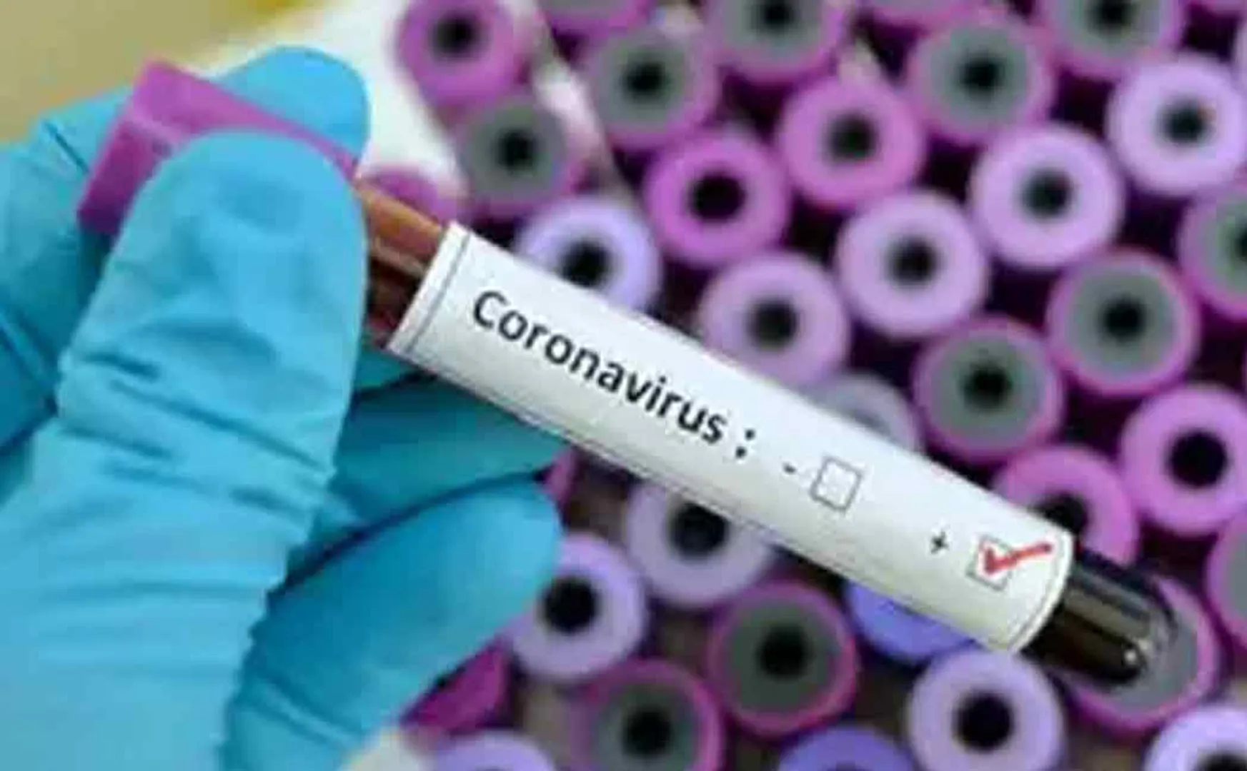Corona infection confirmed for medical college students ..!