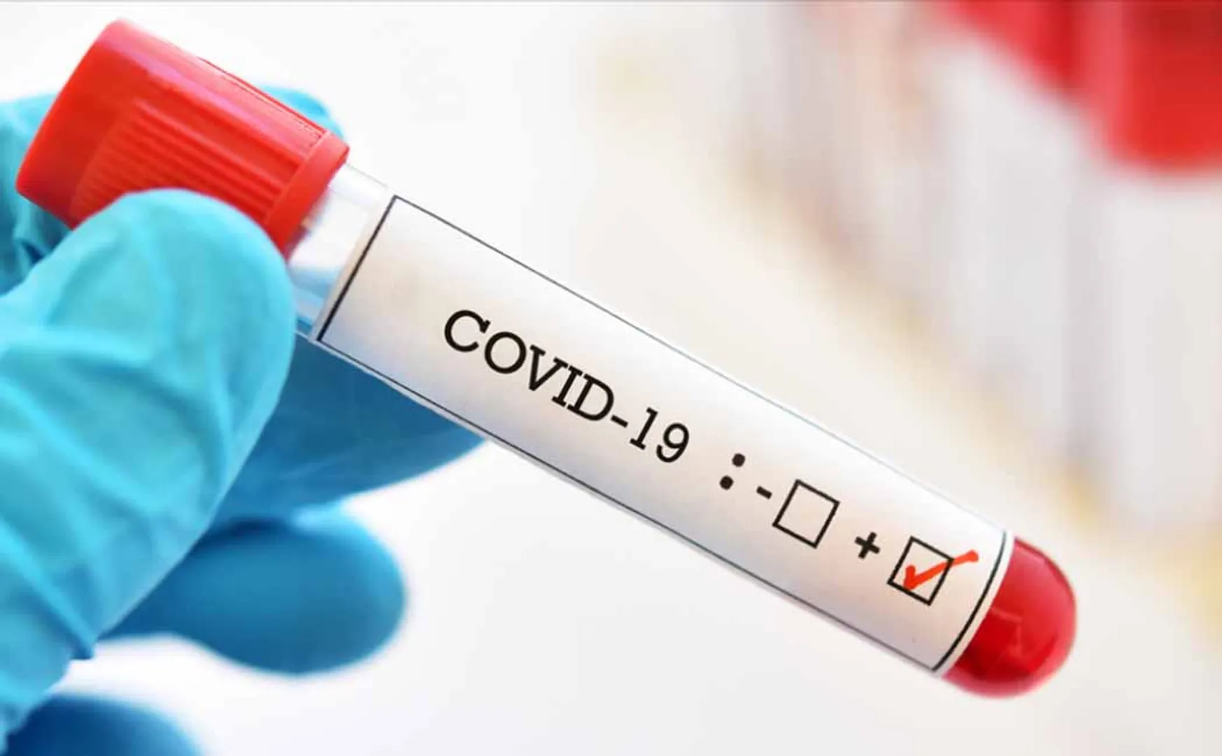 tamilnadu health department today covid cases 