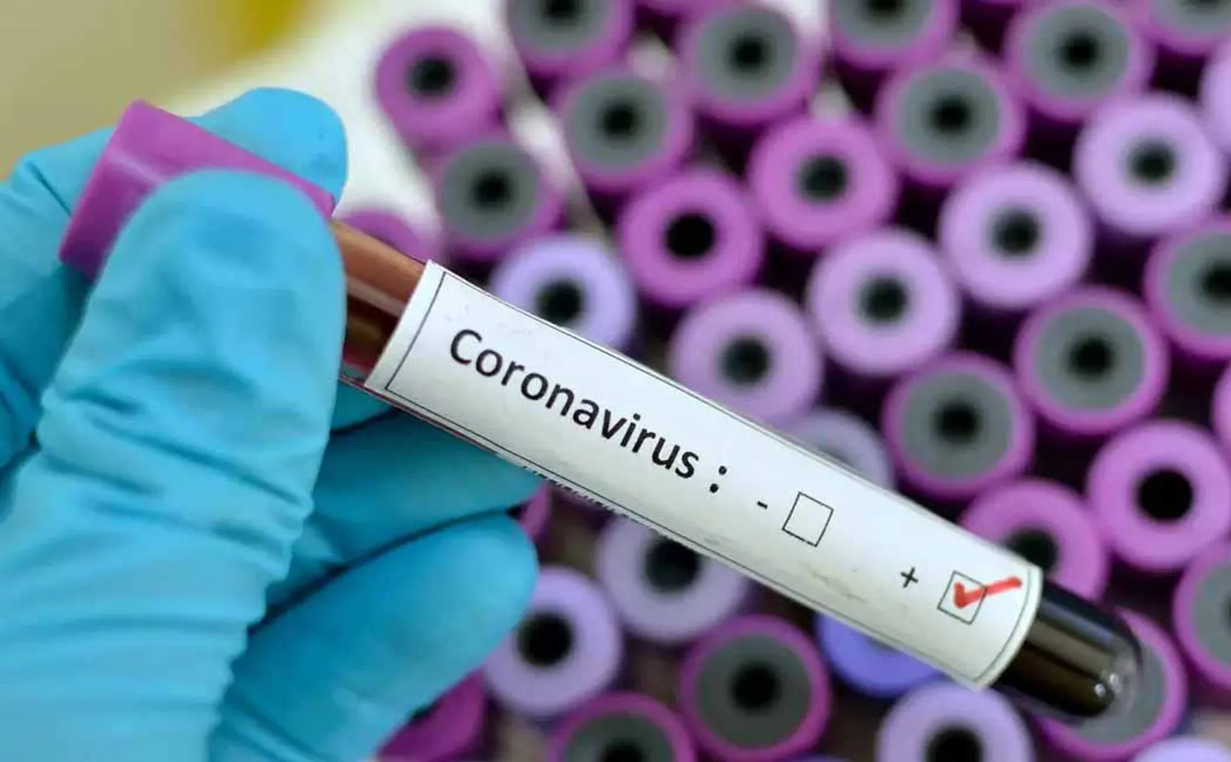 puducherry coronavirus cases increased 