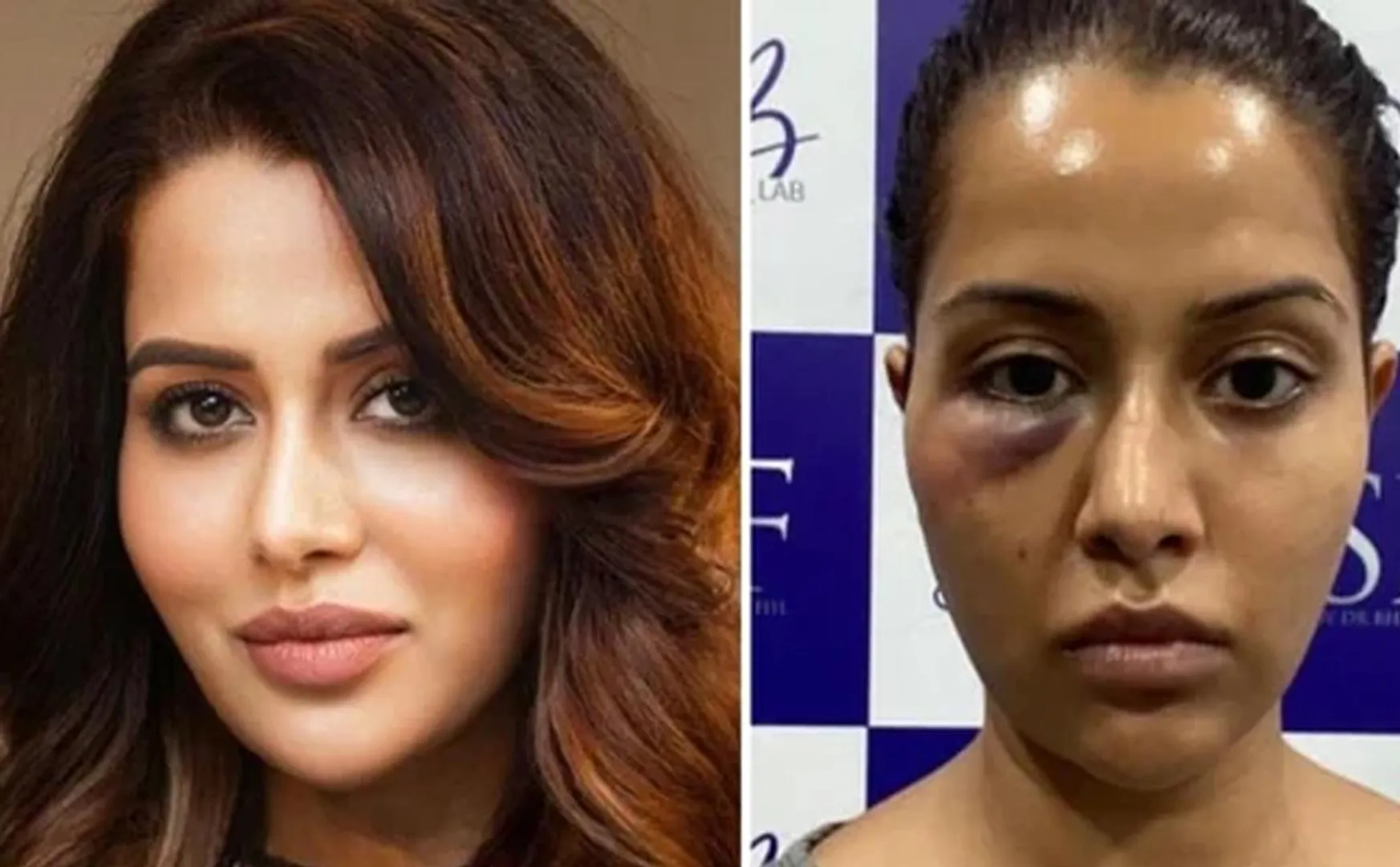 DEFOMATION NOTICE ISSUED ACTRESS RAISA WITH DOCTOR 