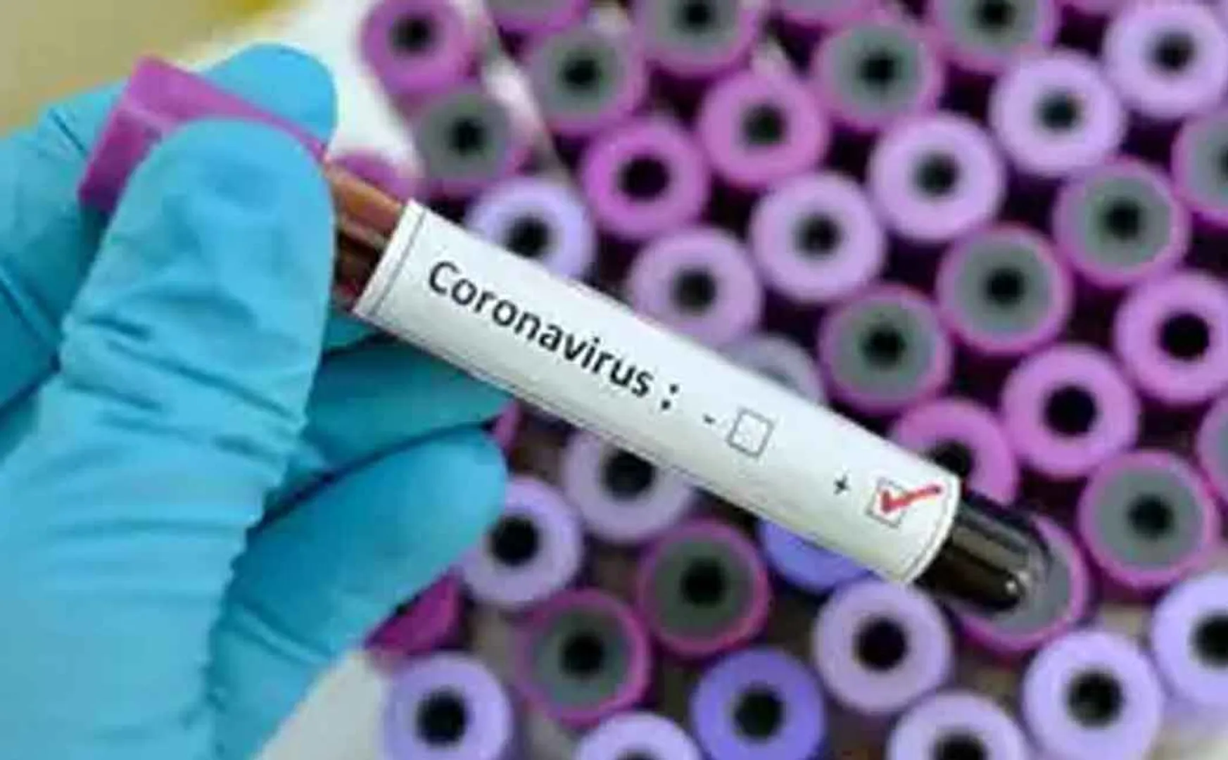 1,746 new cases of corona infection confirmed