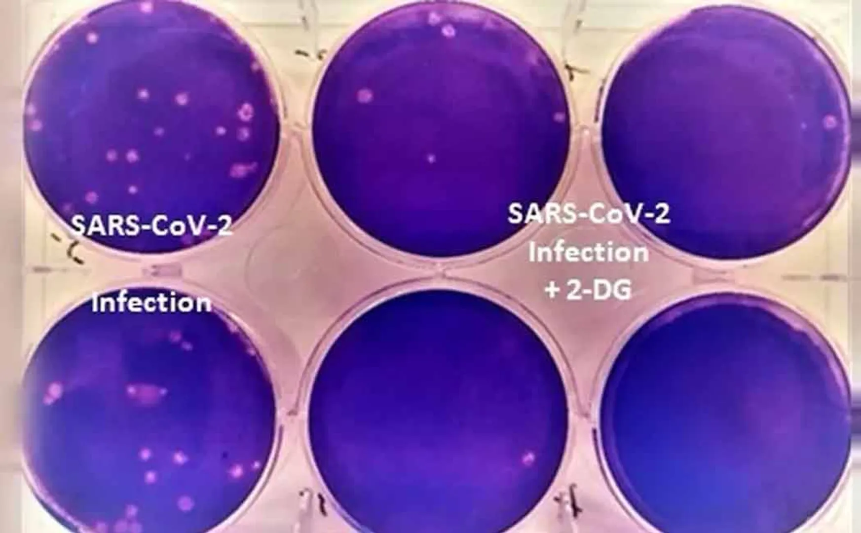 dcgi approves new covid drug discovered by drdo