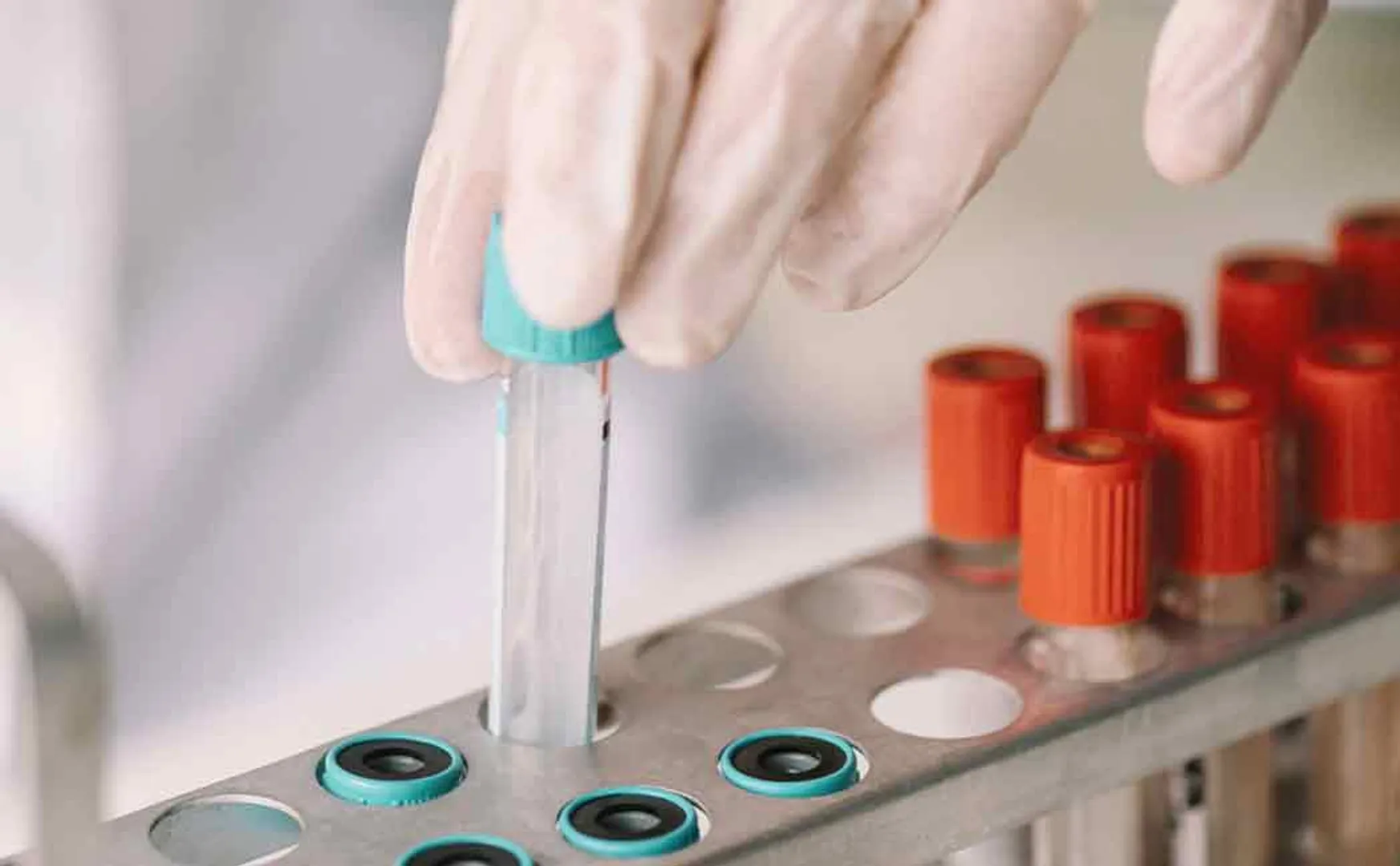 Corona test results issue 2 laboratories sealed in Salem ..!