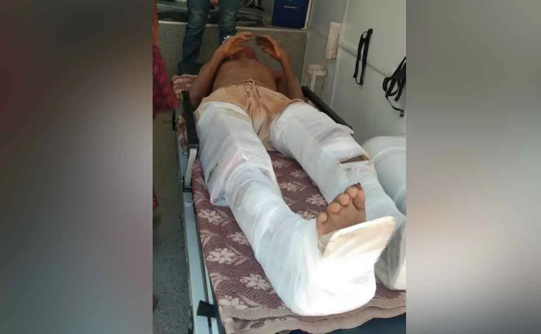 Elephant stepping on an old man .... legs broken