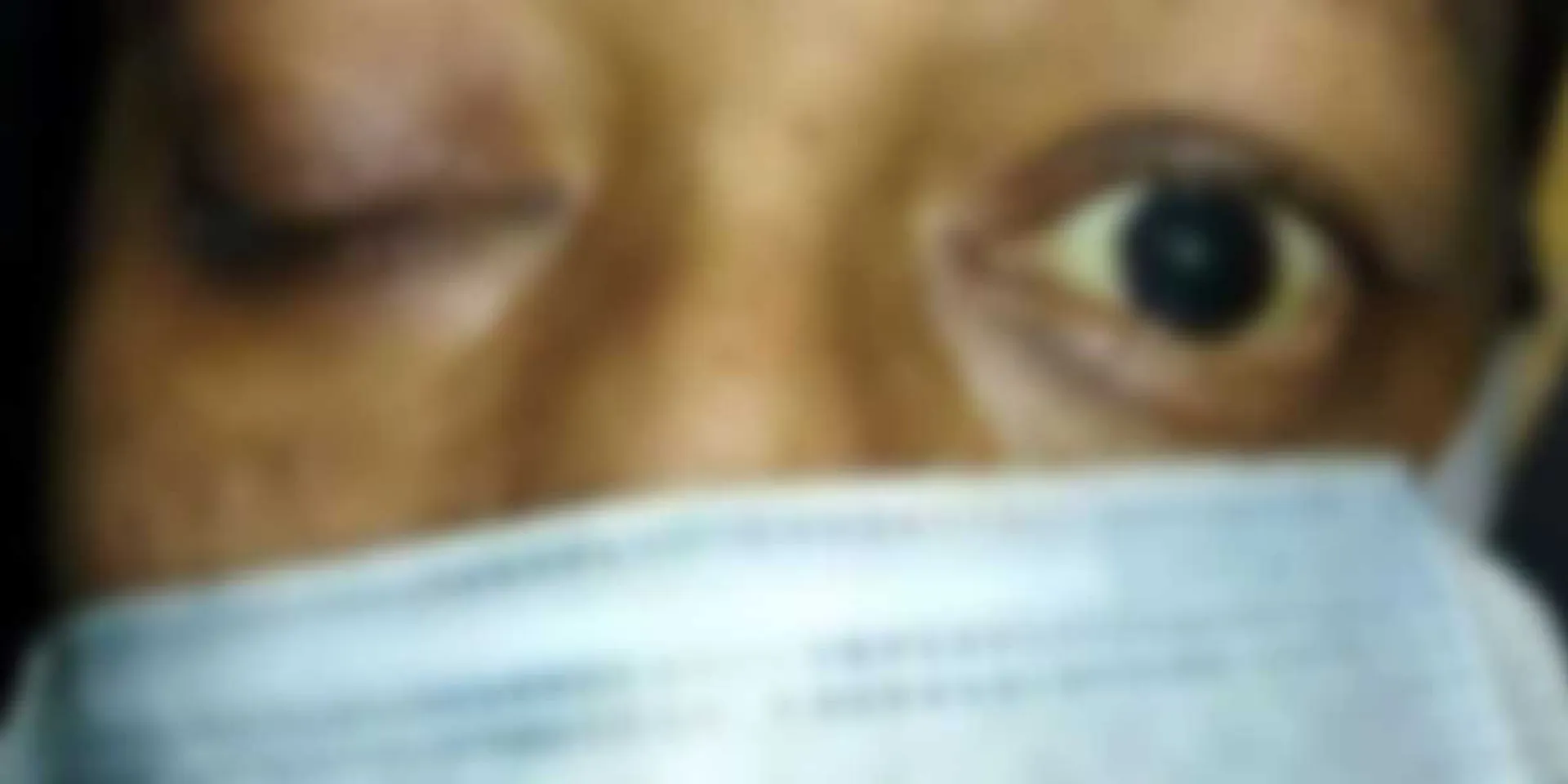 Thirty people infected with the black fungus have lost their sight-shock in Coimbatore
