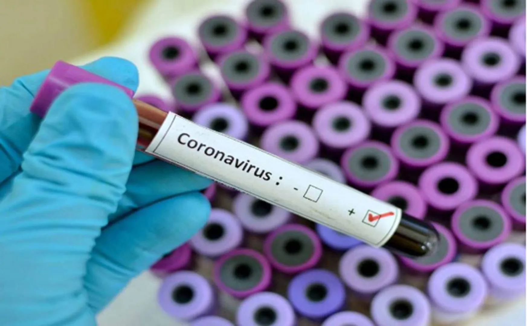 TAMILNADU CORONAVIRUS UPDATE FOR TODAY 