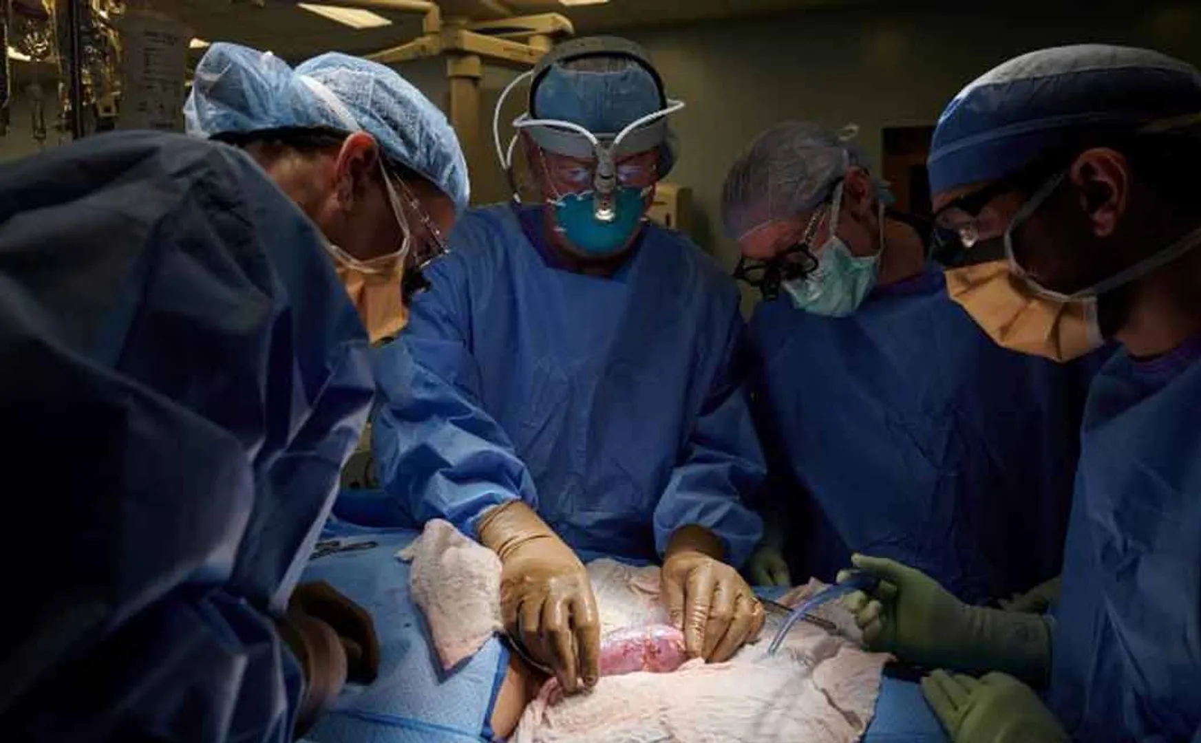 US SURGEONS 