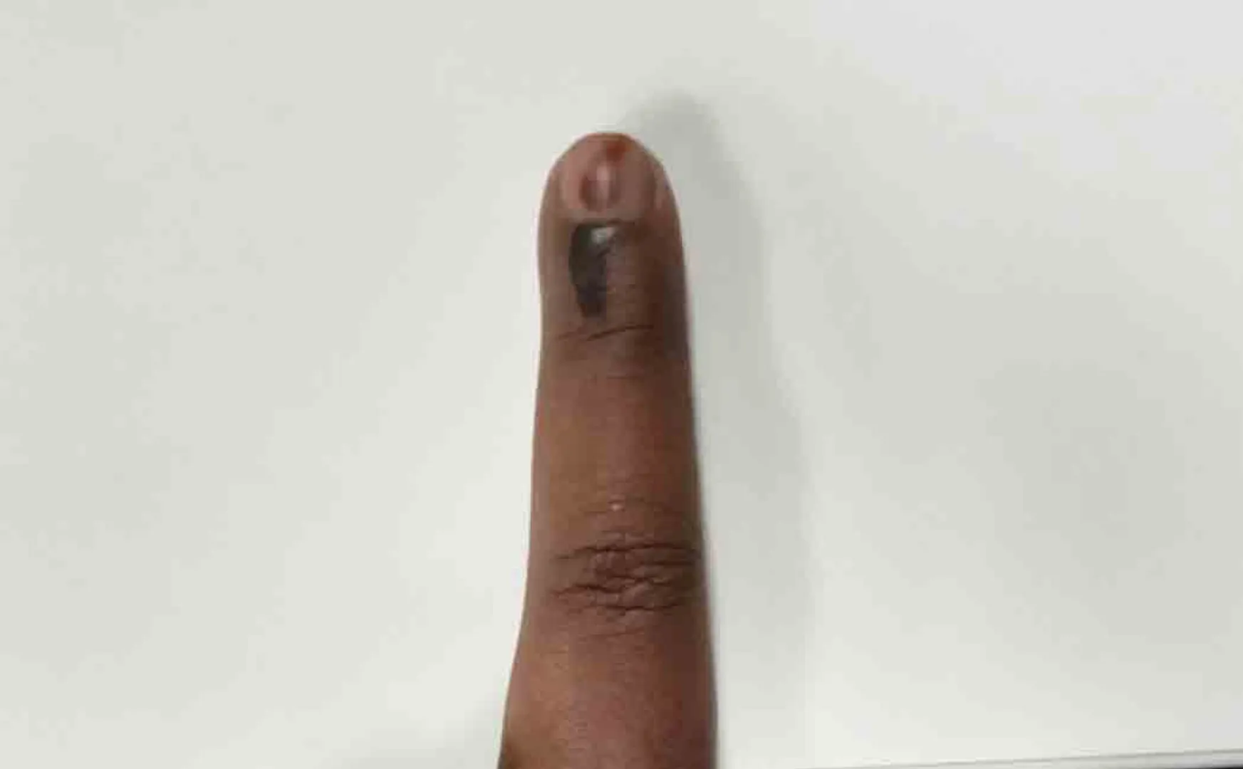 How do we achieve 100% turnout?