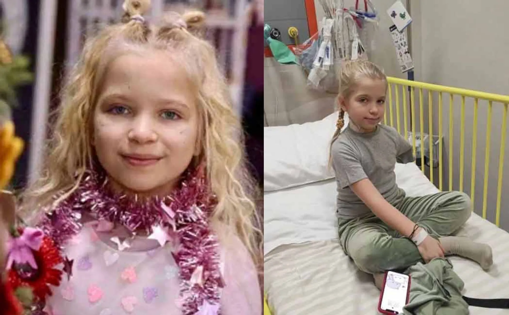 9 year old ukrainian girl lost her hand in russian invasion