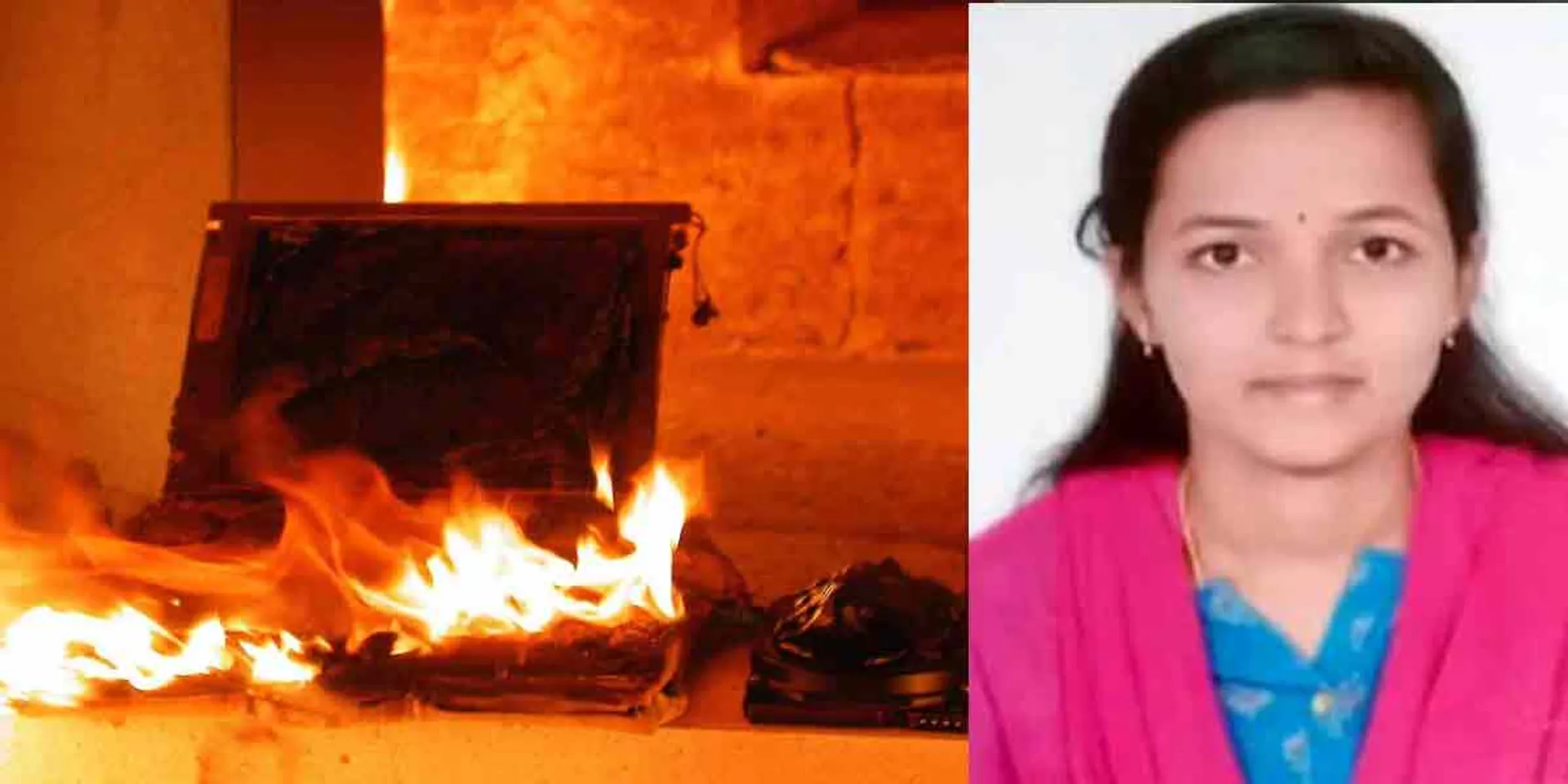  Laptop explodes accident ... teen fighting for life!
