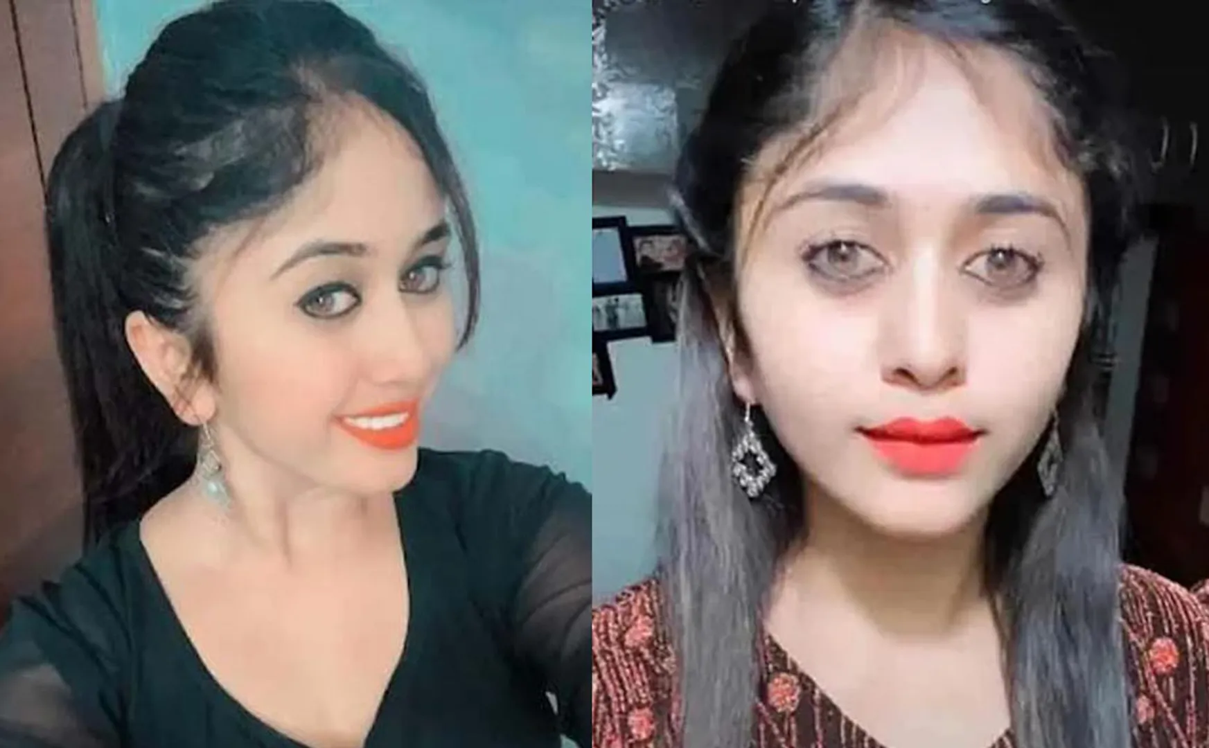 Famous actress who died due to plastic surgery