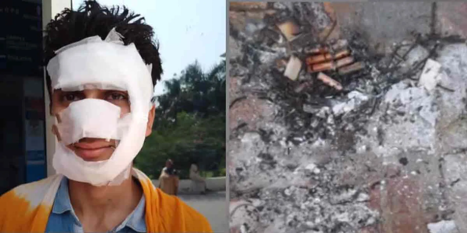  The person who made the bomb by watching YouTube has been arrested!
