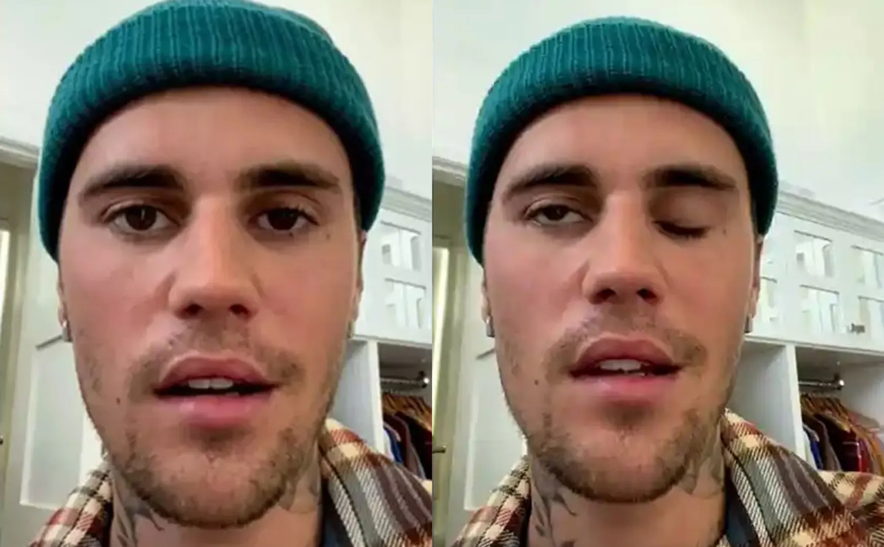 Justin Bieber cancels justice world tour shows after half face left paralysed virus 
