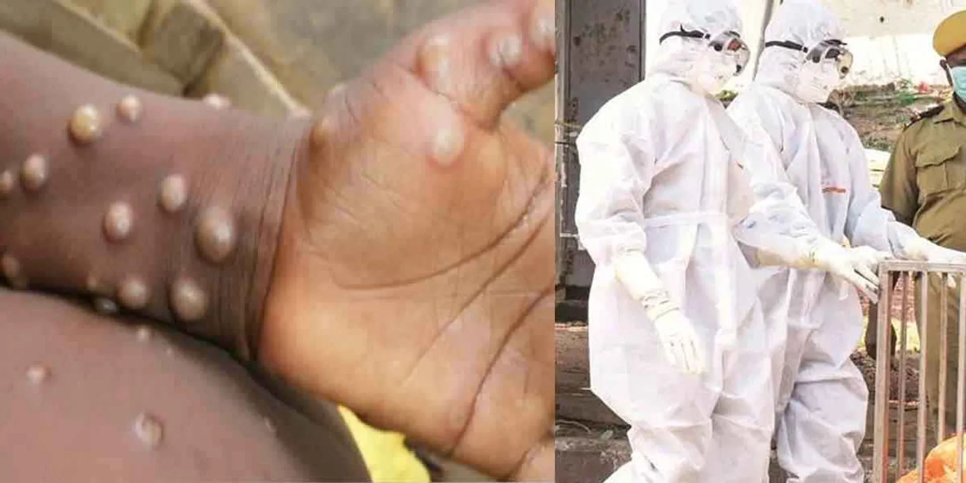 Monkey measles in Kerala?- Shock!