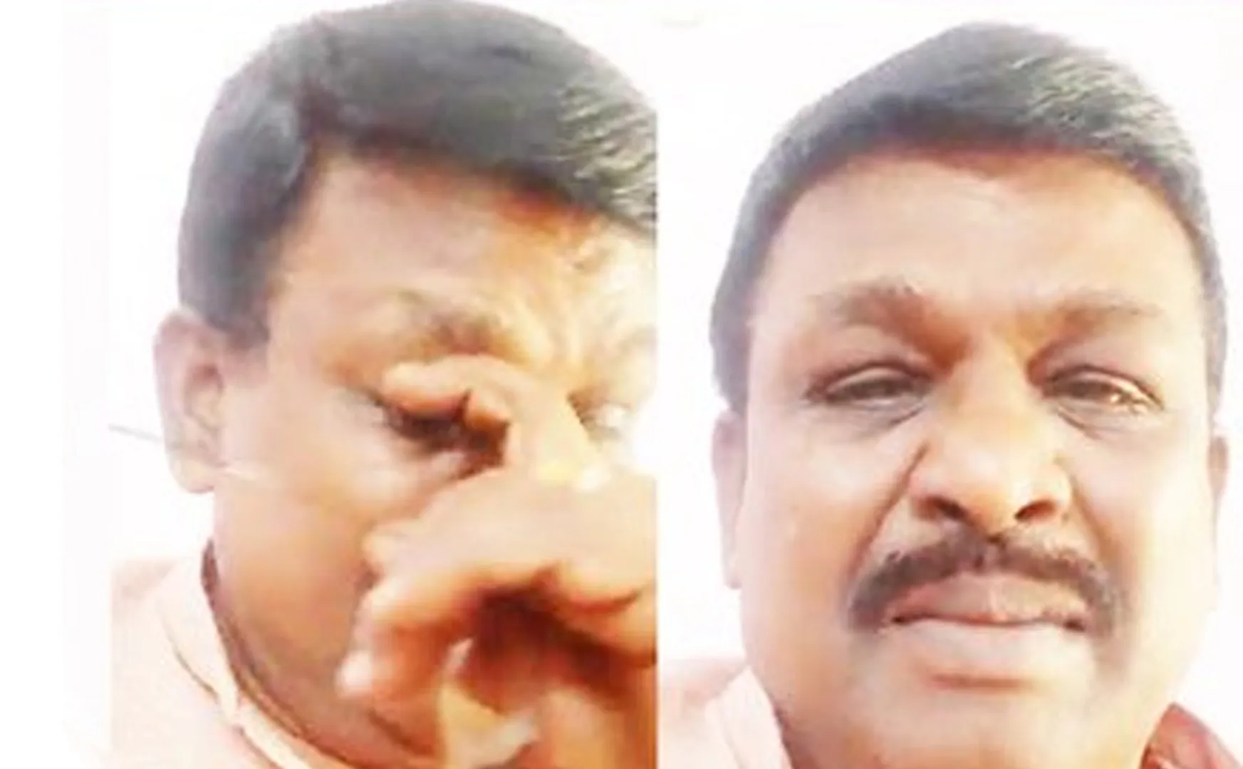 Actor Benjamin request help treatment Bondamani