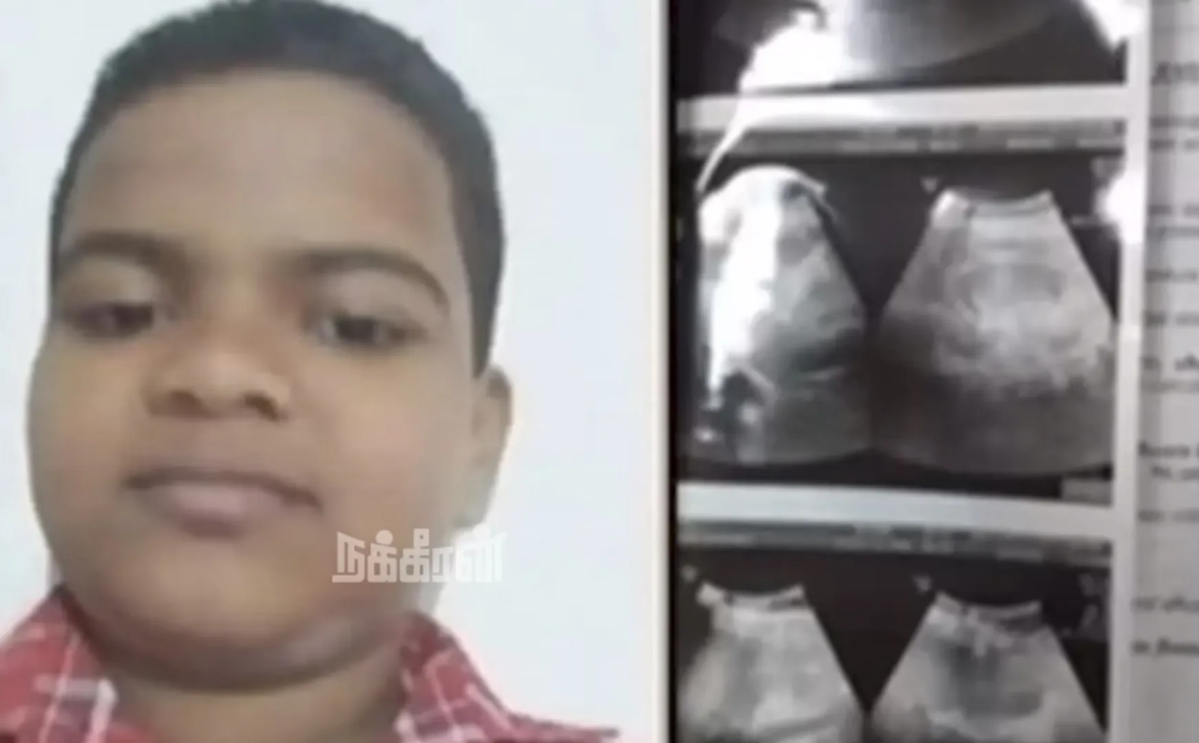 Acid juice was given 6th student issue kanniyakumari