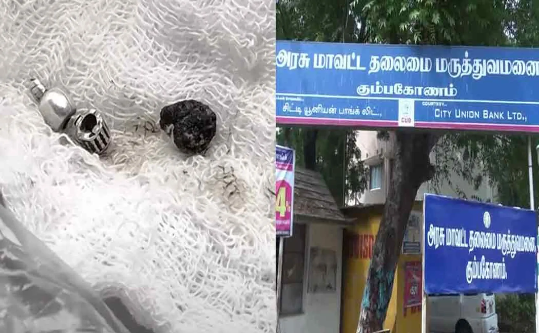 Negligence in Government Hospital; Ambalam stitched with Colus