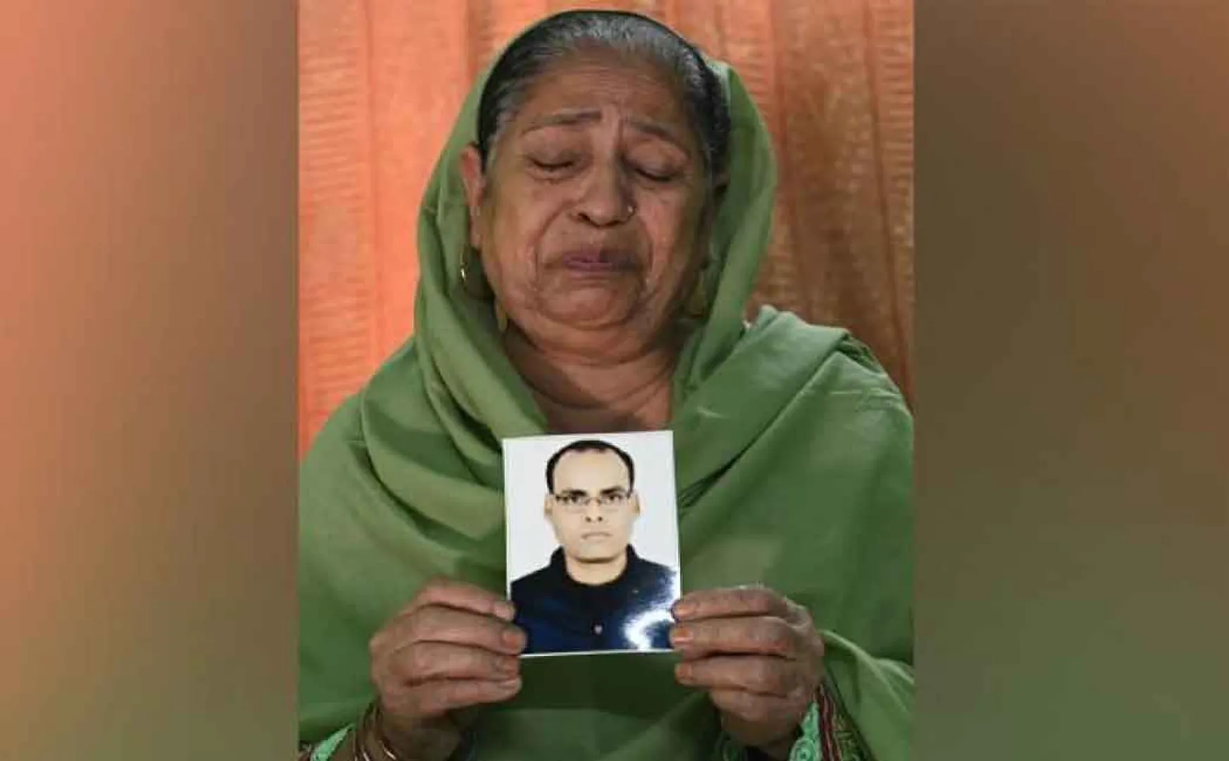 hair tranlsplantation treatment  in delhi; 30 year old man passed away