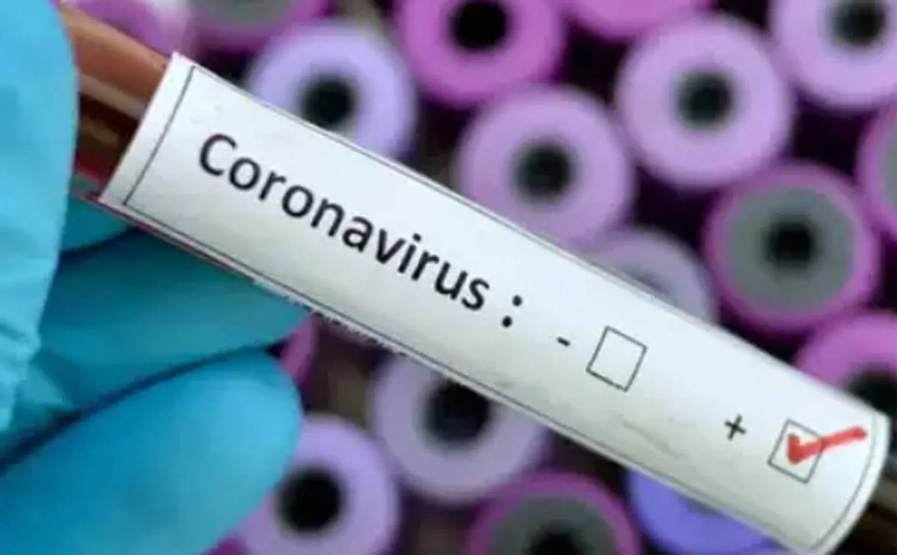 Two persons came Tamil Nadu from China have been positive corona virus