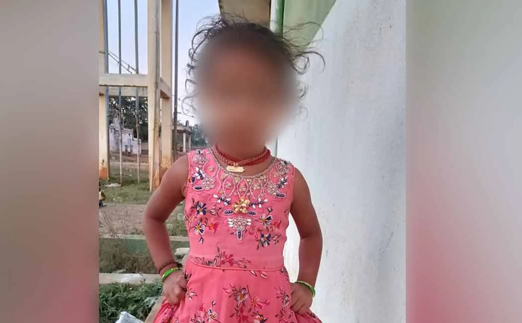 4-year-old girl was admitted to hospital after being bitten by dogs near Manaparai