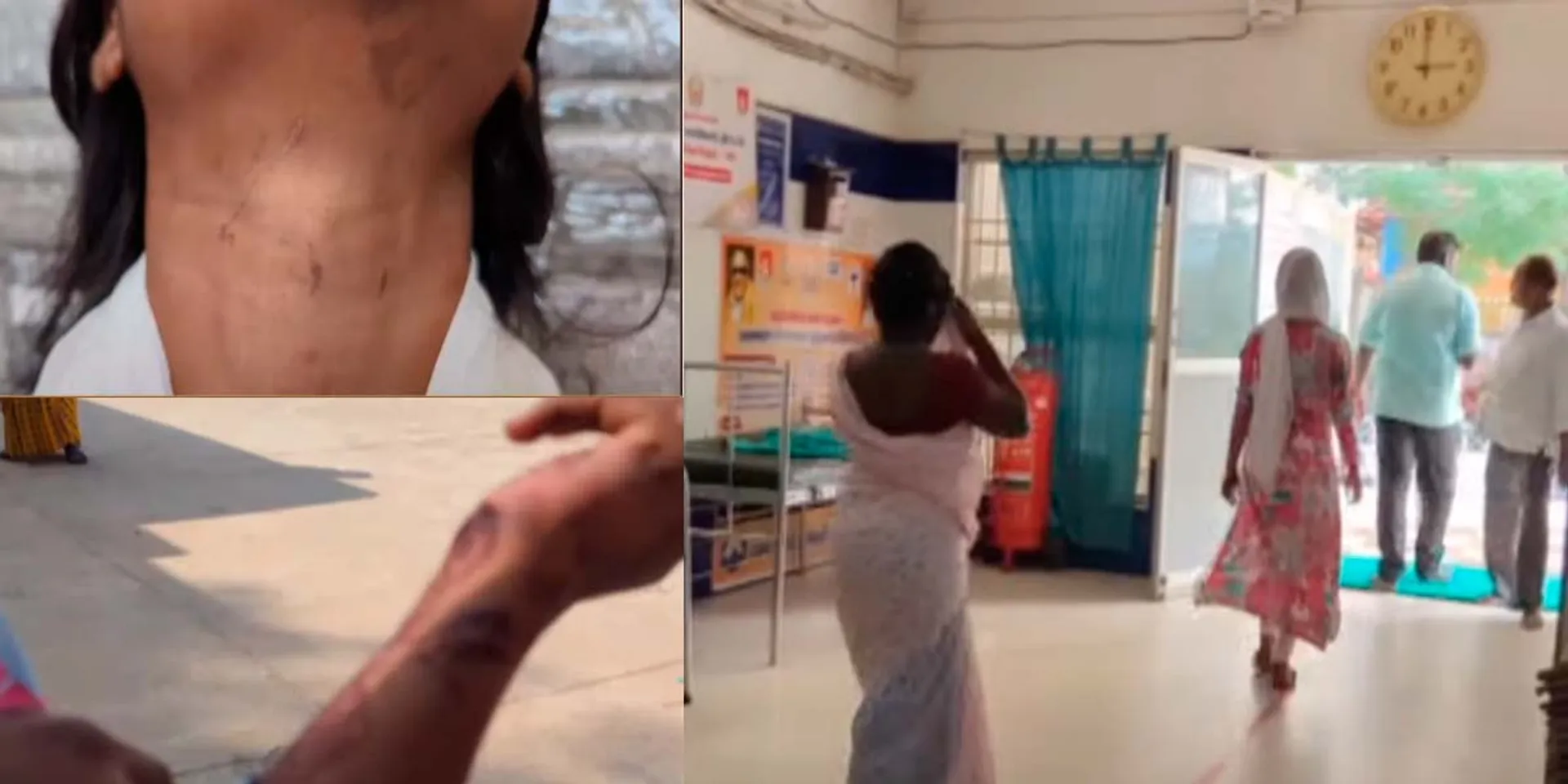 Torture of a woman who came to work as a domestic worker; Police case against DMK MLA's son