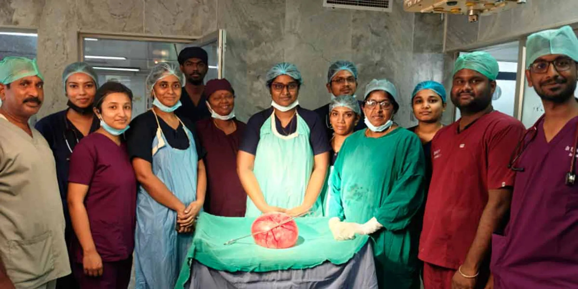 Removal of 5 kg sphincter tumor from female stomach; Achievement of Government Medical College Doctors