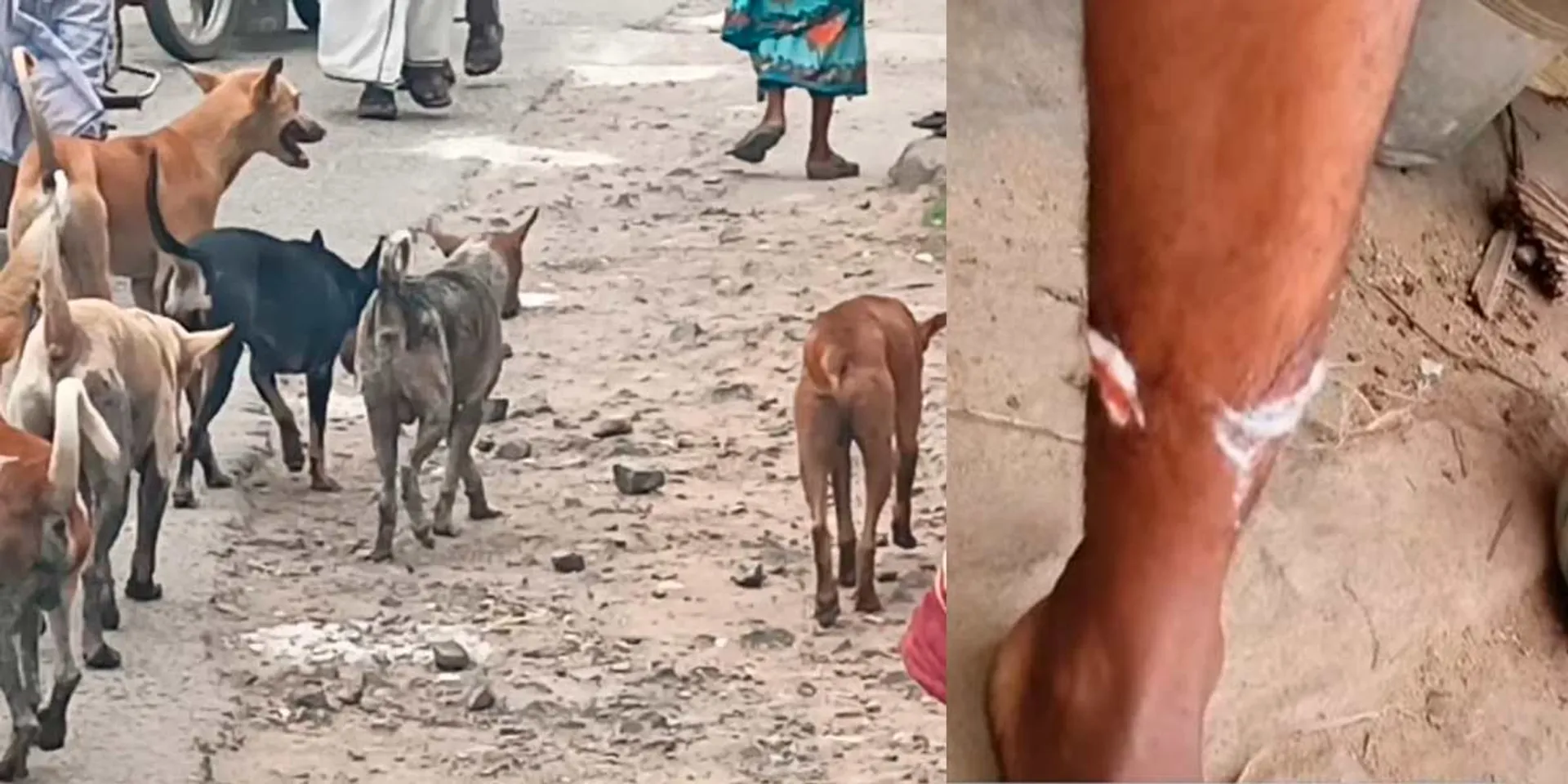 Dogs that chase and bite; 12 people were injured