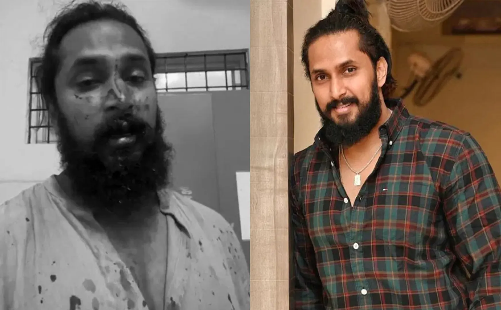 kannada actor Chetan Chandra seriously injured in mob attack