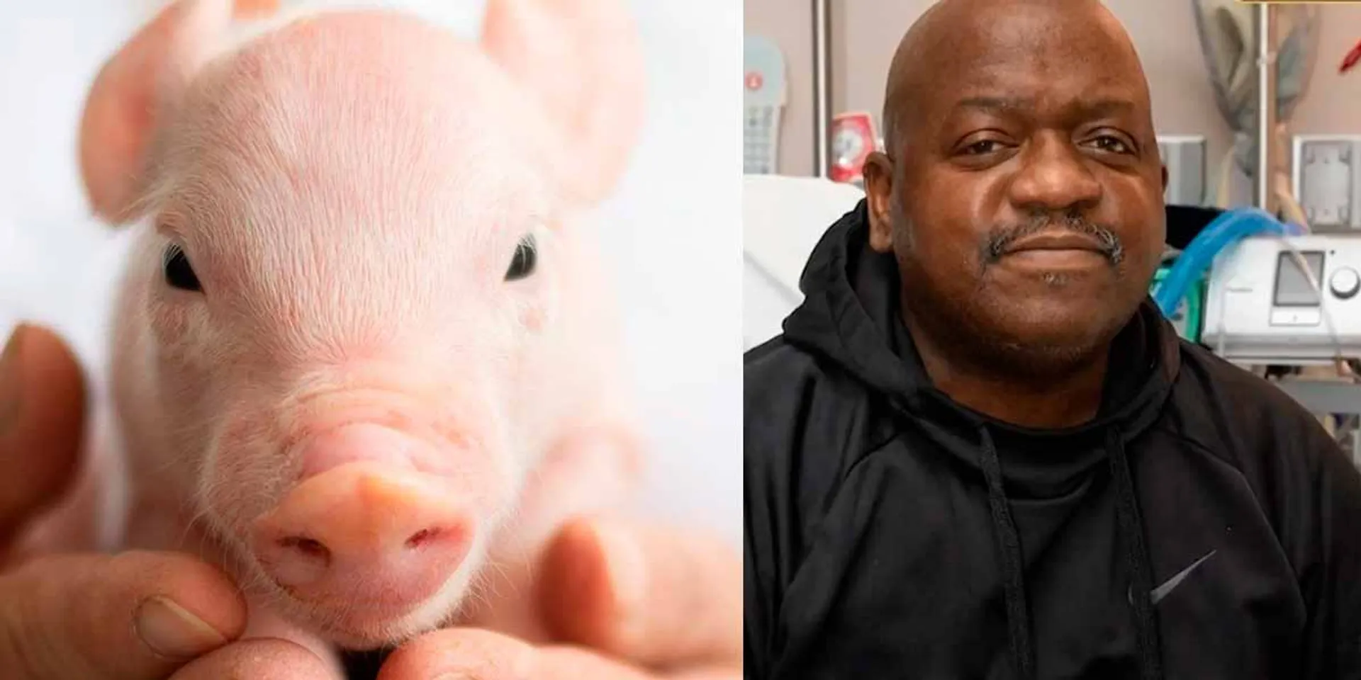 A pig kidney transplanted into a human; The skid fell on the milestone achievement