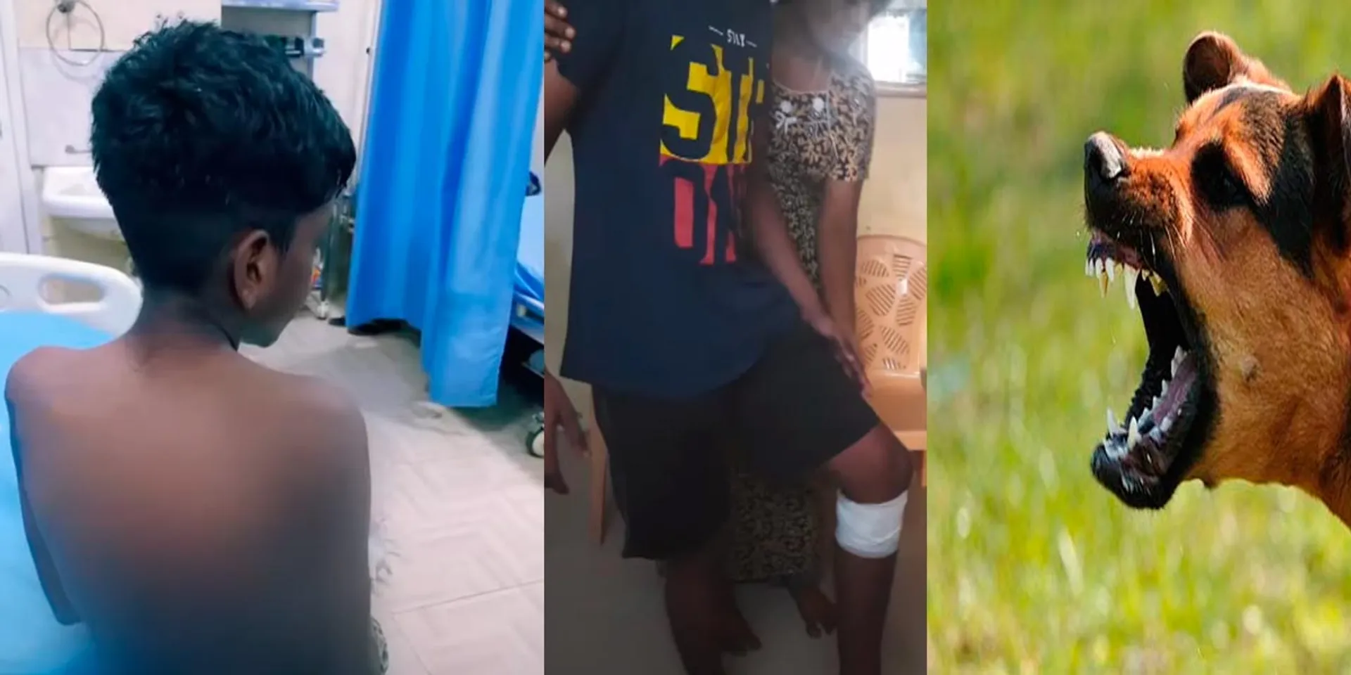  Again the dog bites and injures the boys; Again excitement in Chennai