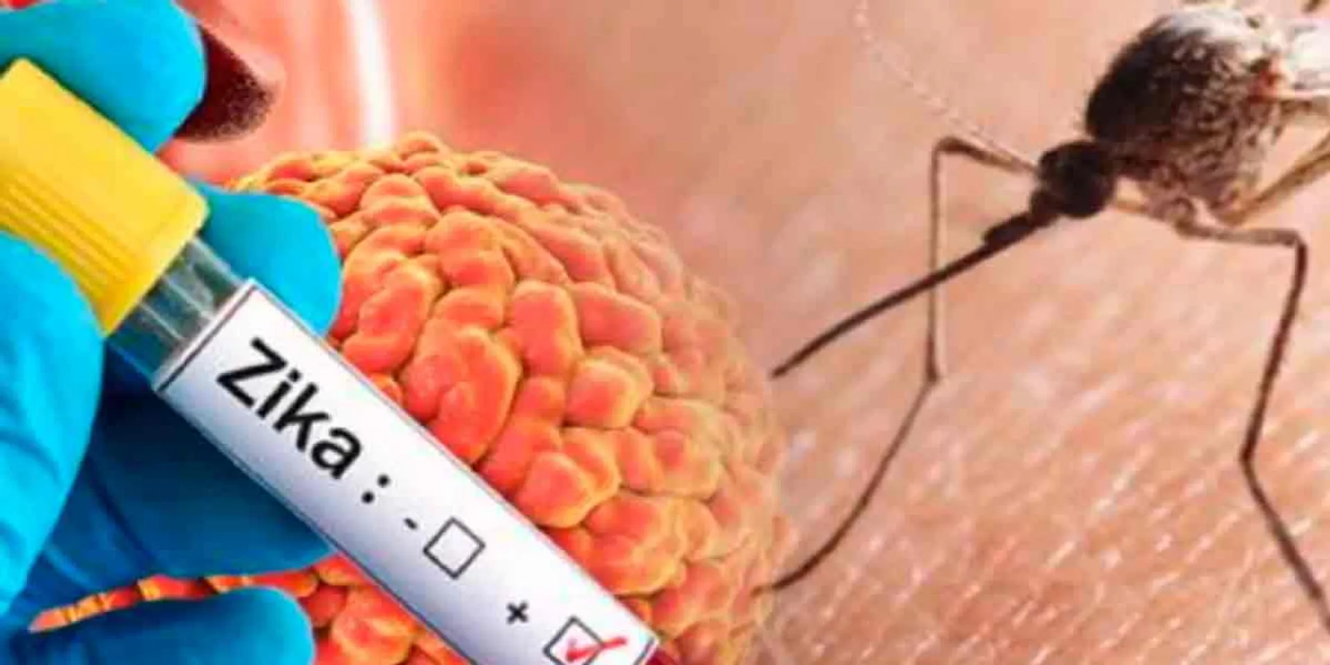 Again 'Zika virus'-warning given to state governments