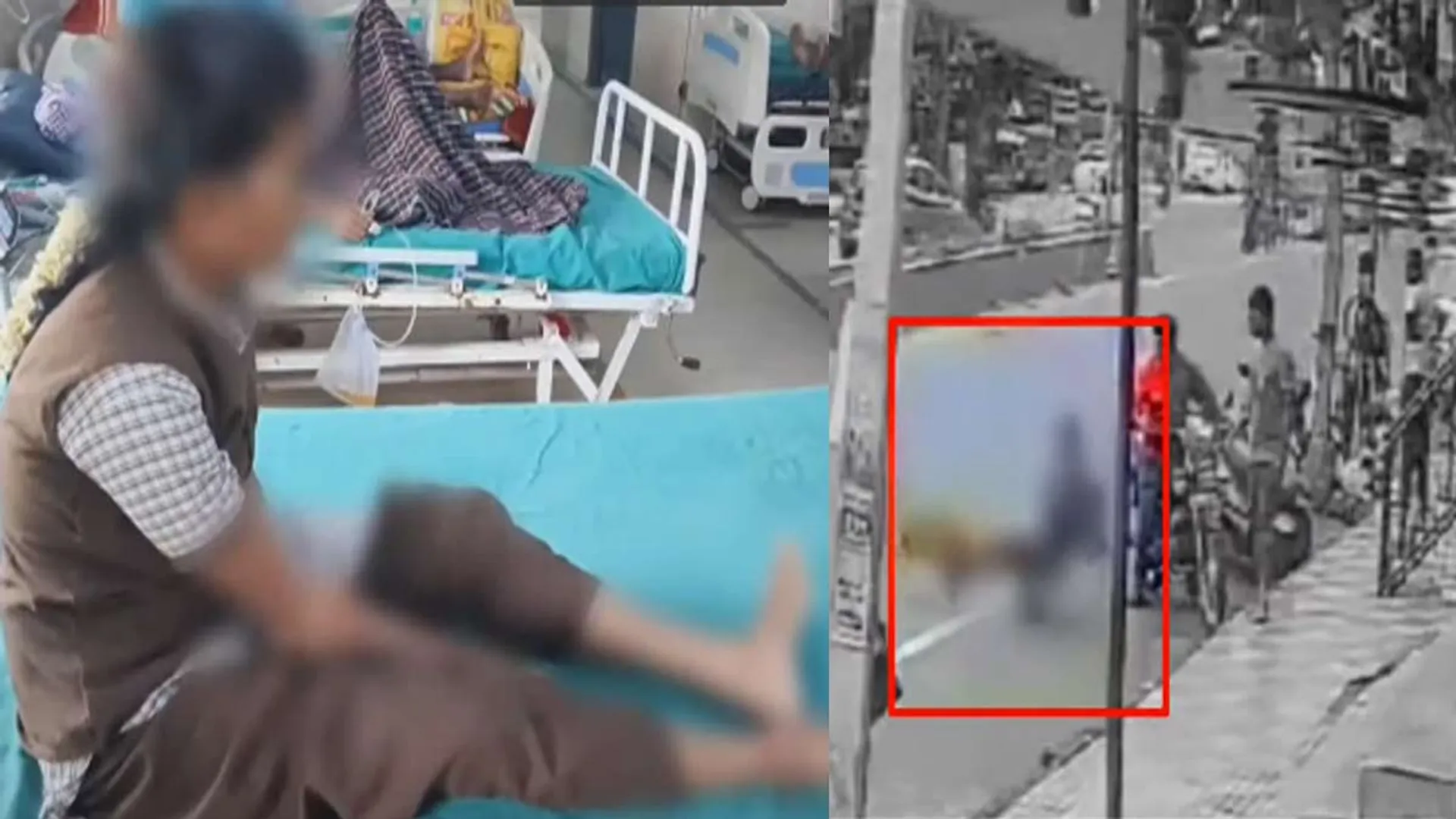  A stray dog ​​that bit madly; College girl injured
